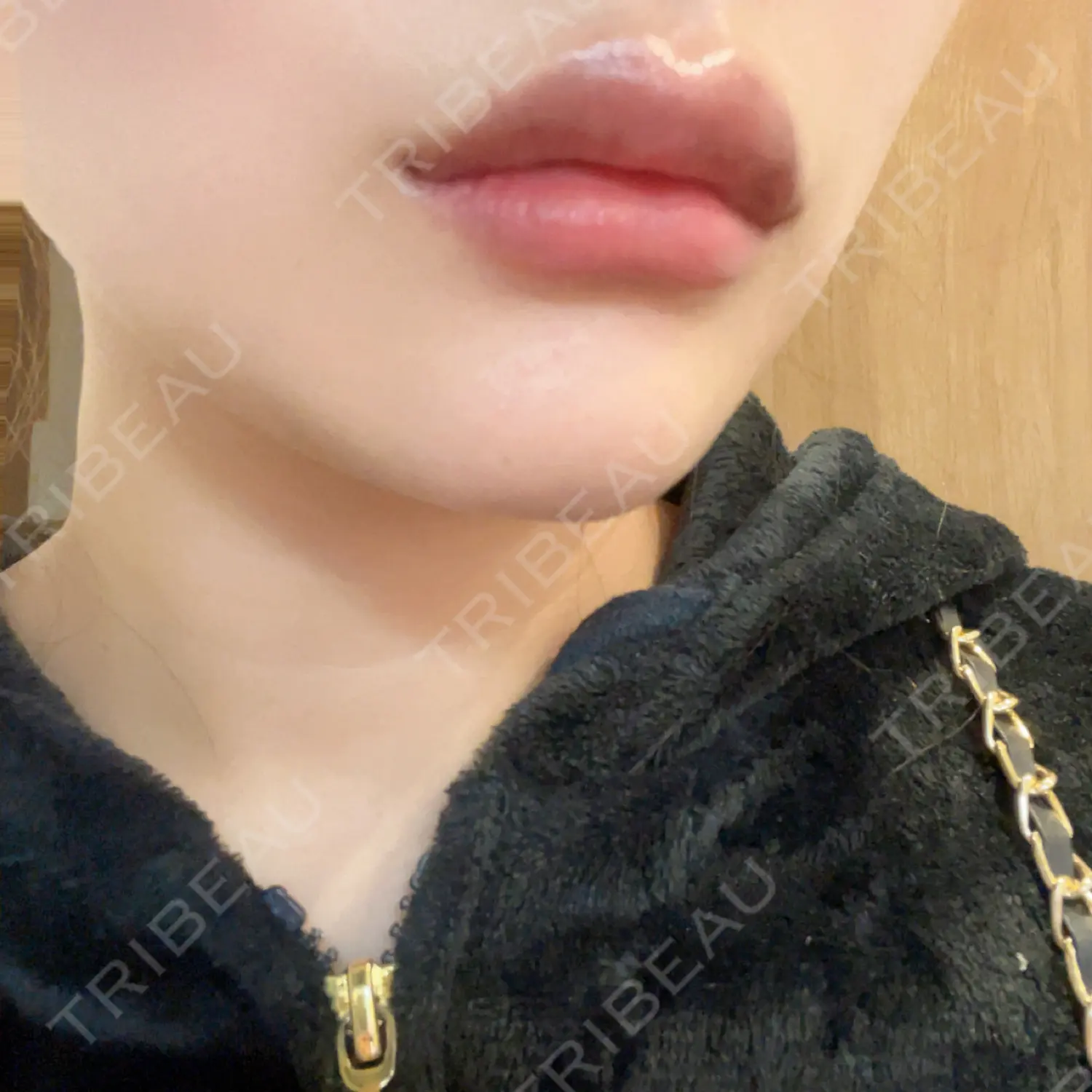 施術後の写真
