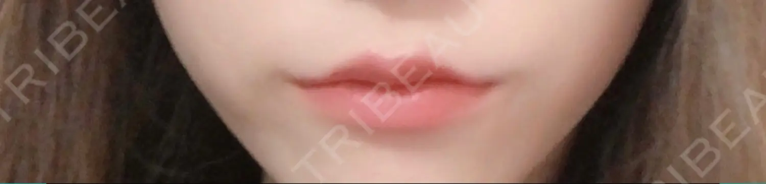 施術後の写真