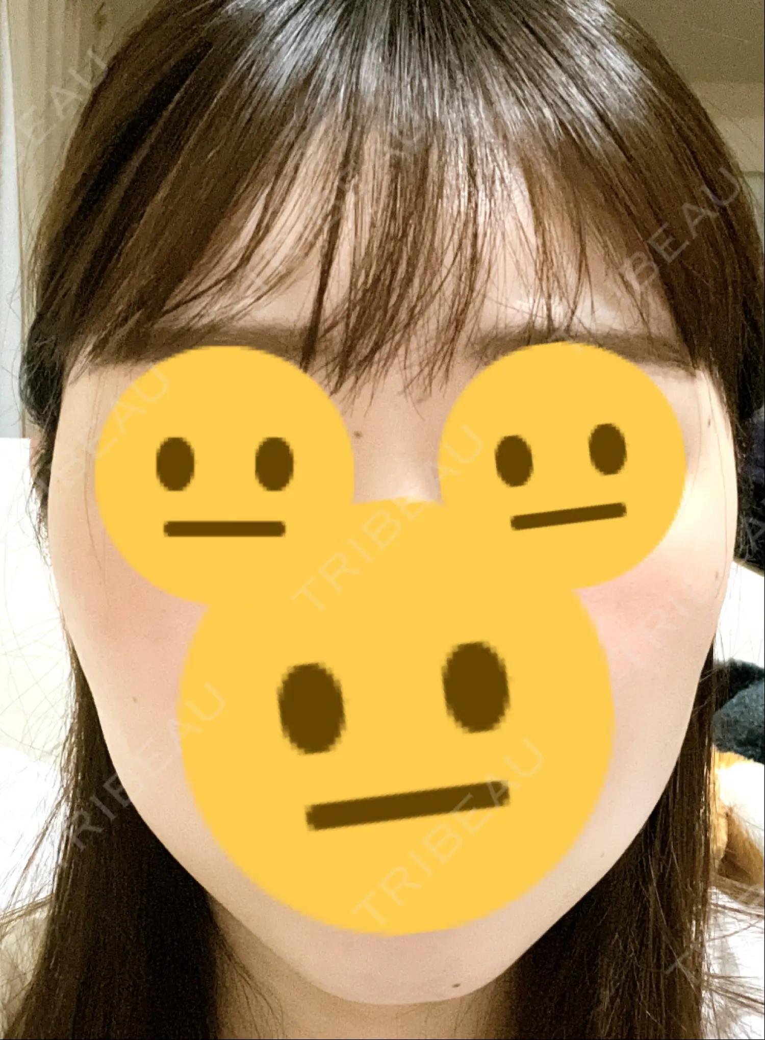 施術後の写真