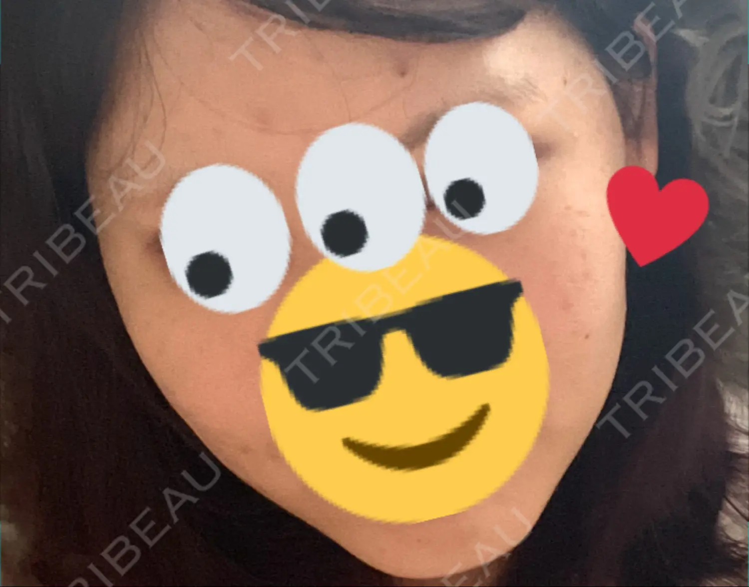施術後の写真