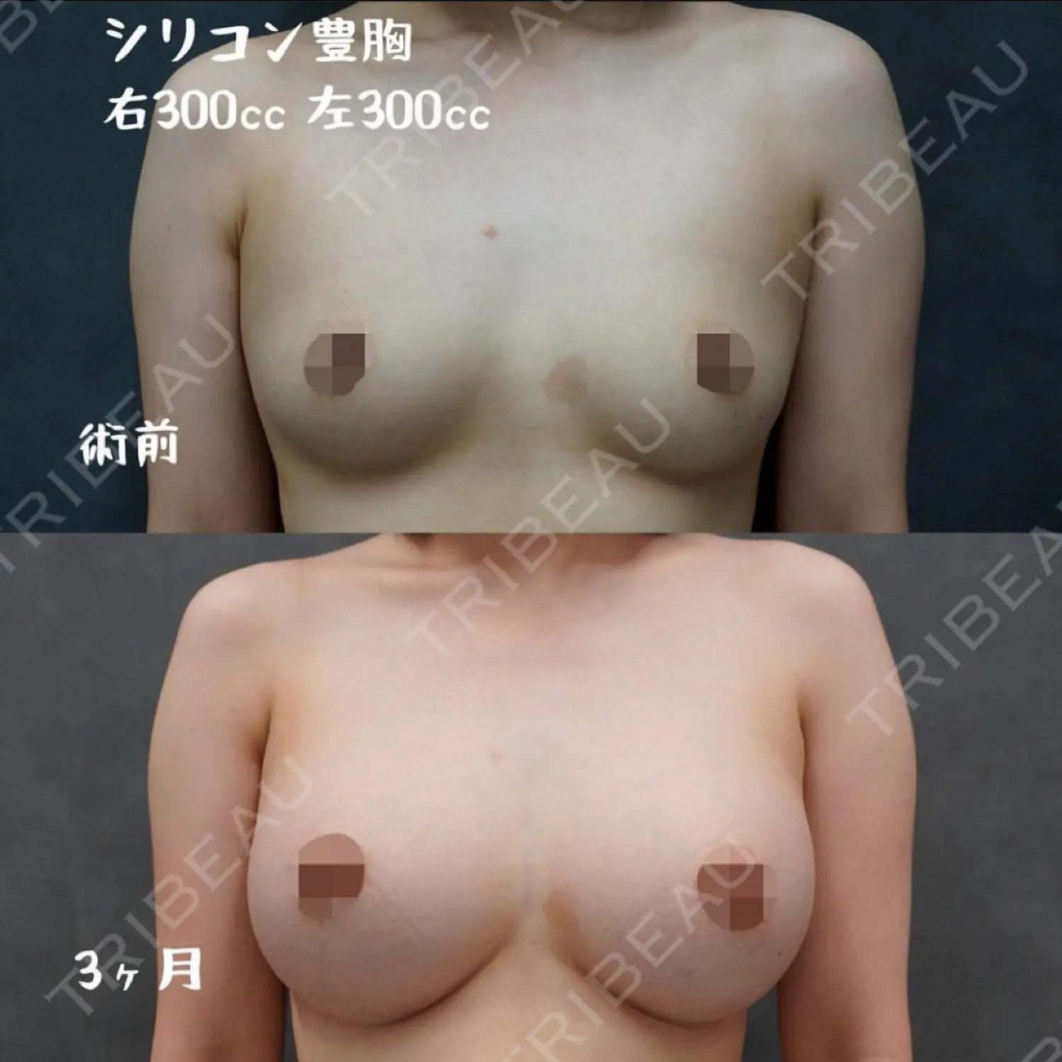 施術後の写真