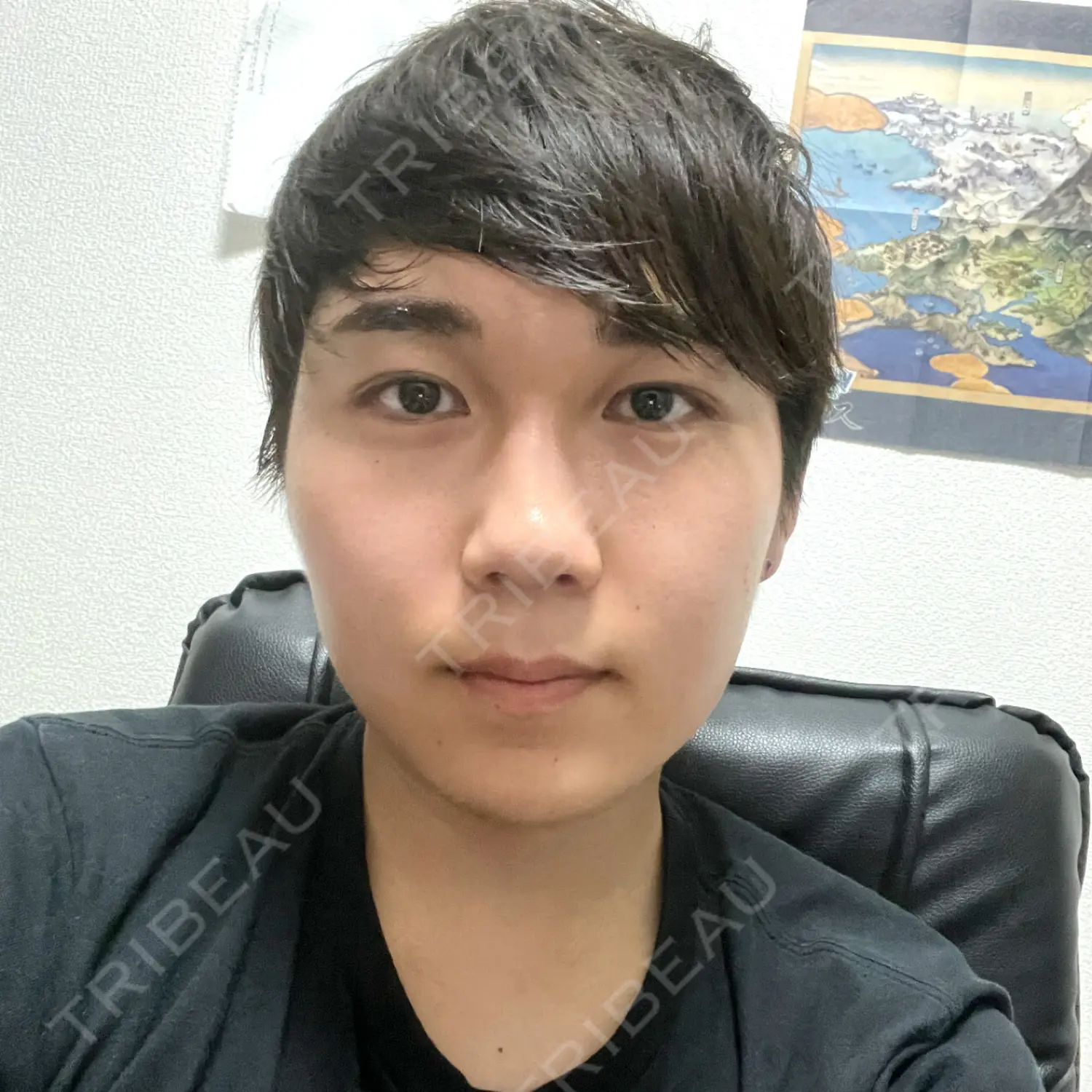 施術後の写真