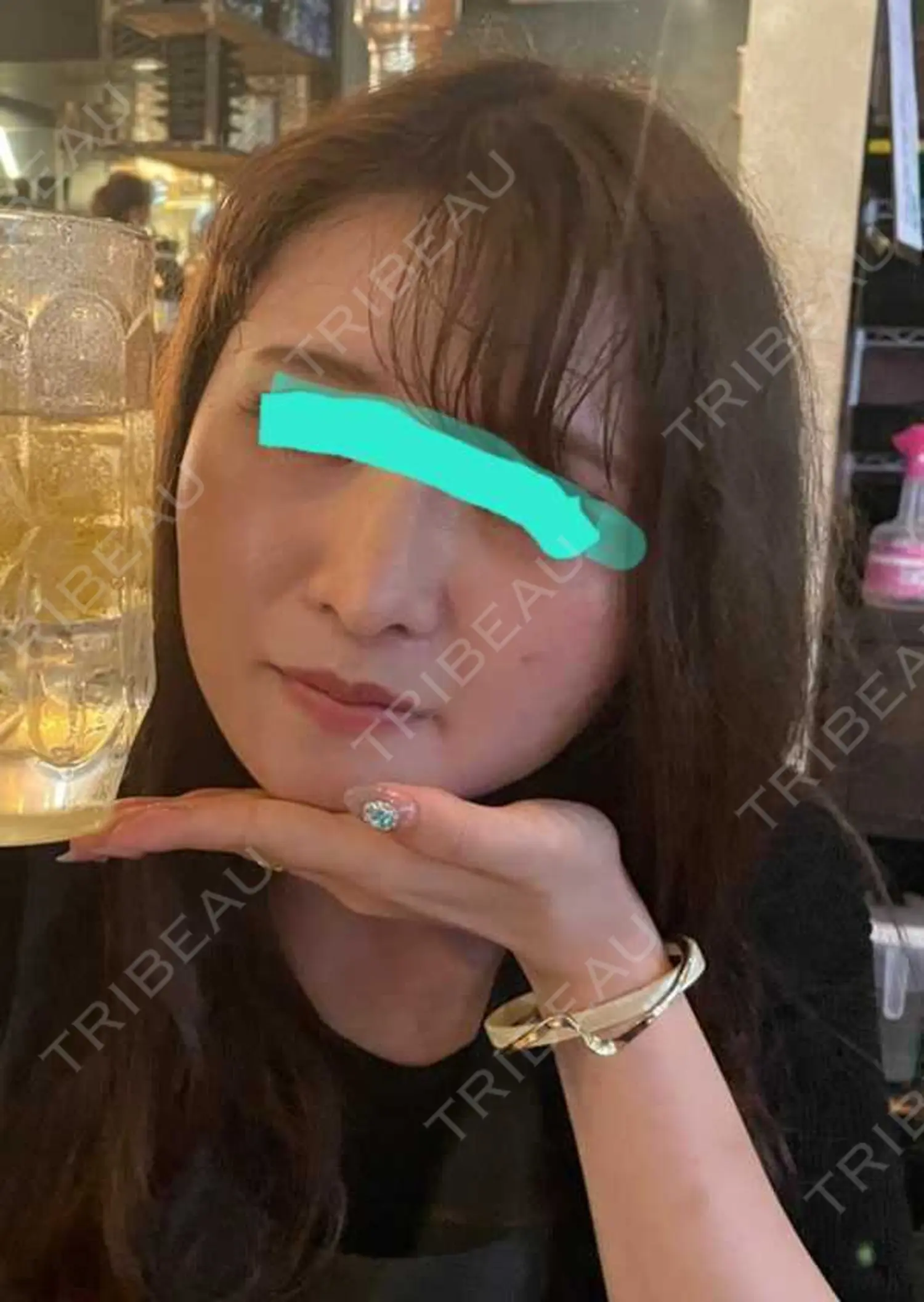 施術後の写真