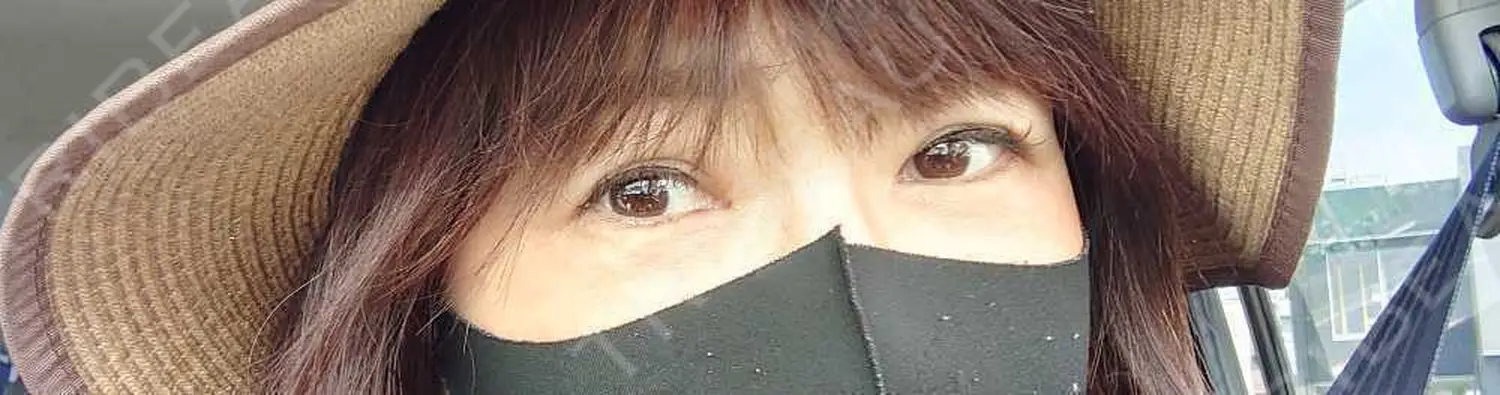 施術後の写真