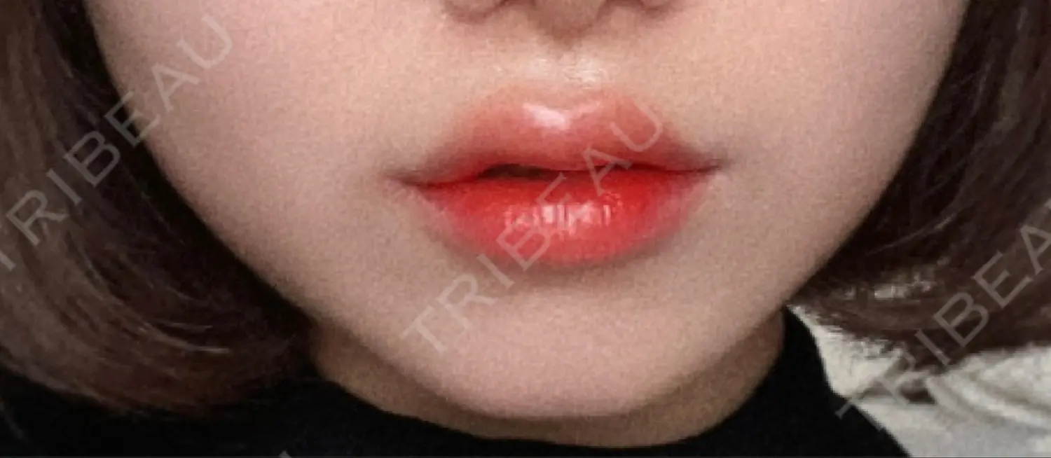 施術後の写真
