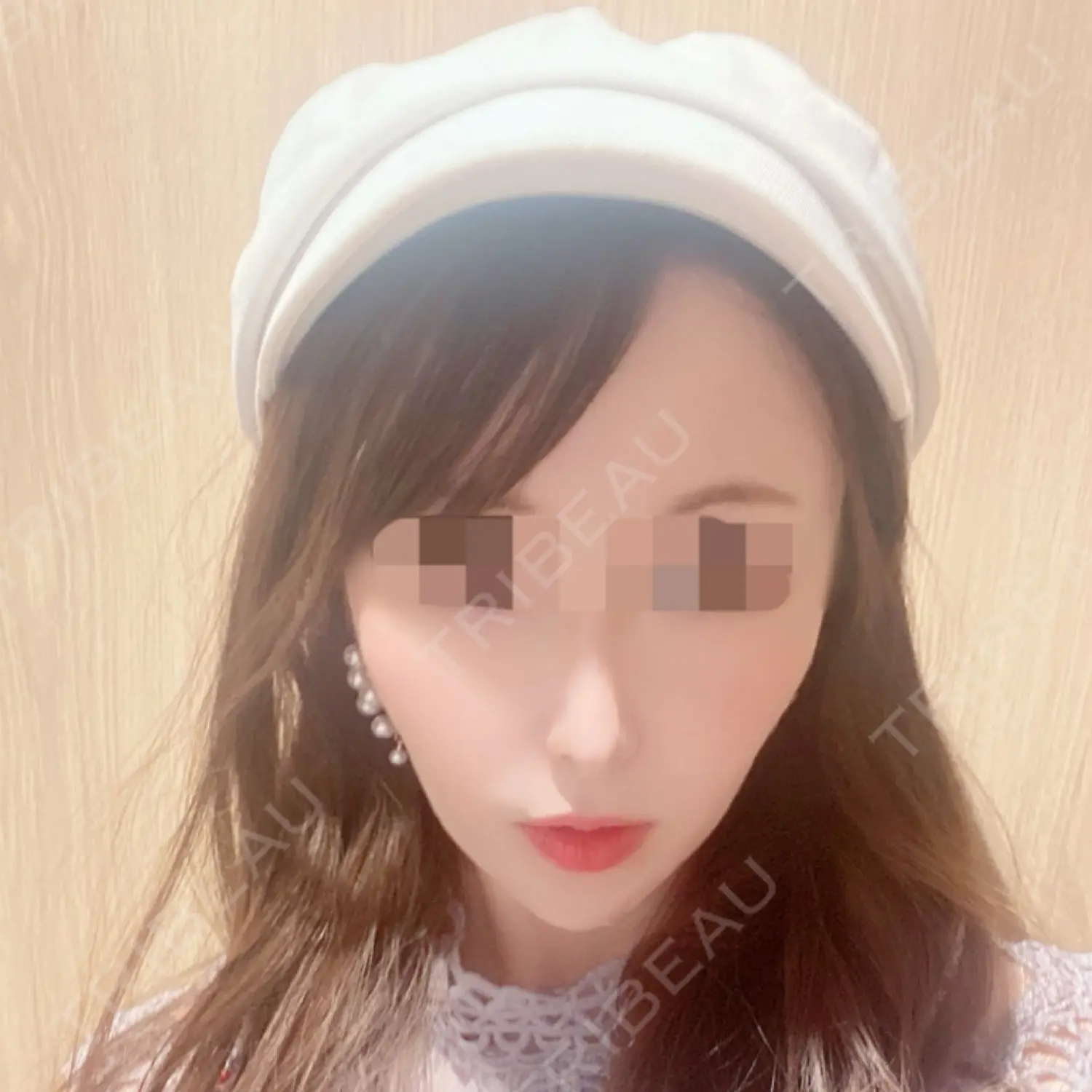施術後の写真