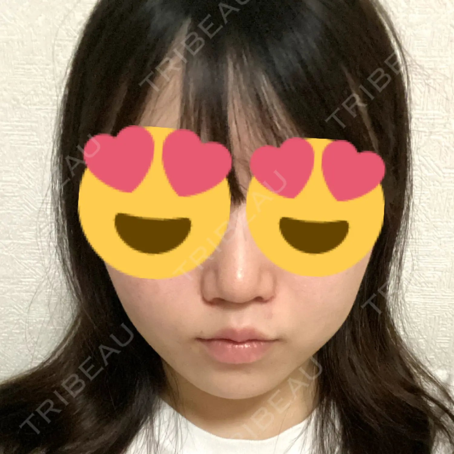 施術後の写真