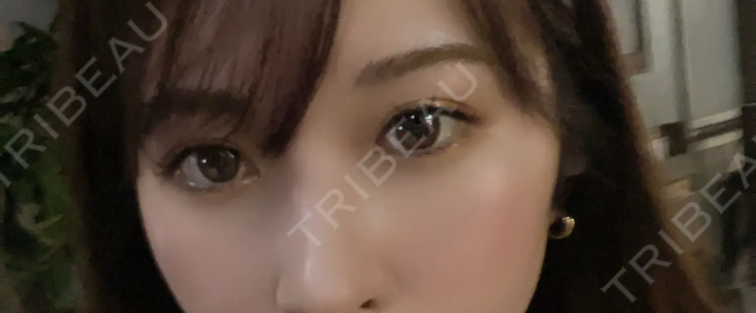施術後の写真