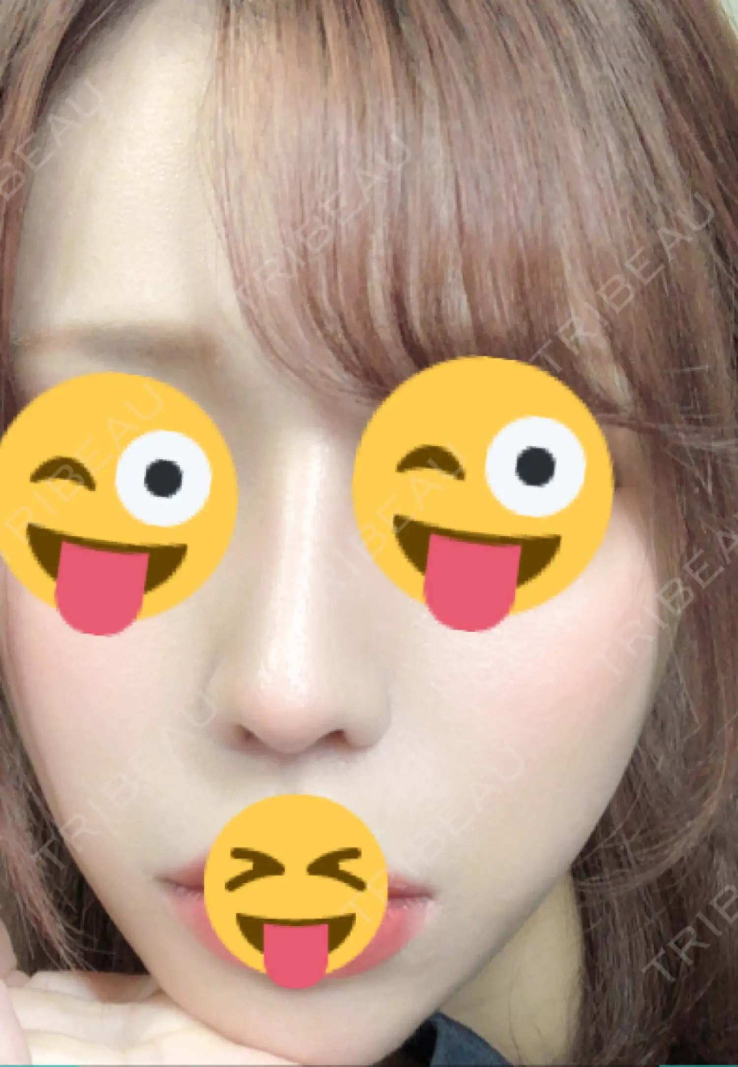 施術後の写真