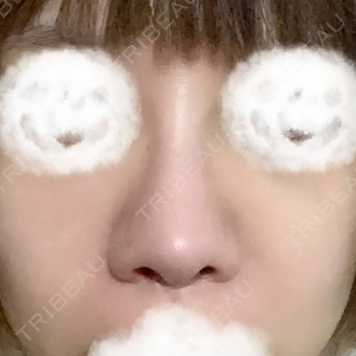 施術後の写真