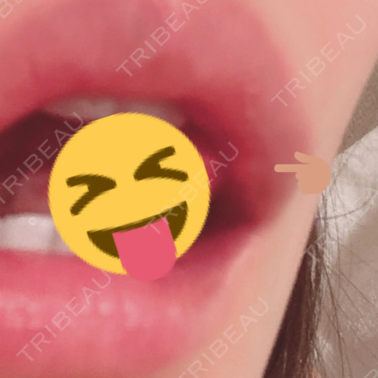 施術後の写真