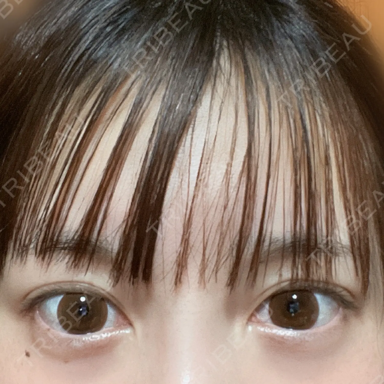 施術後の写真