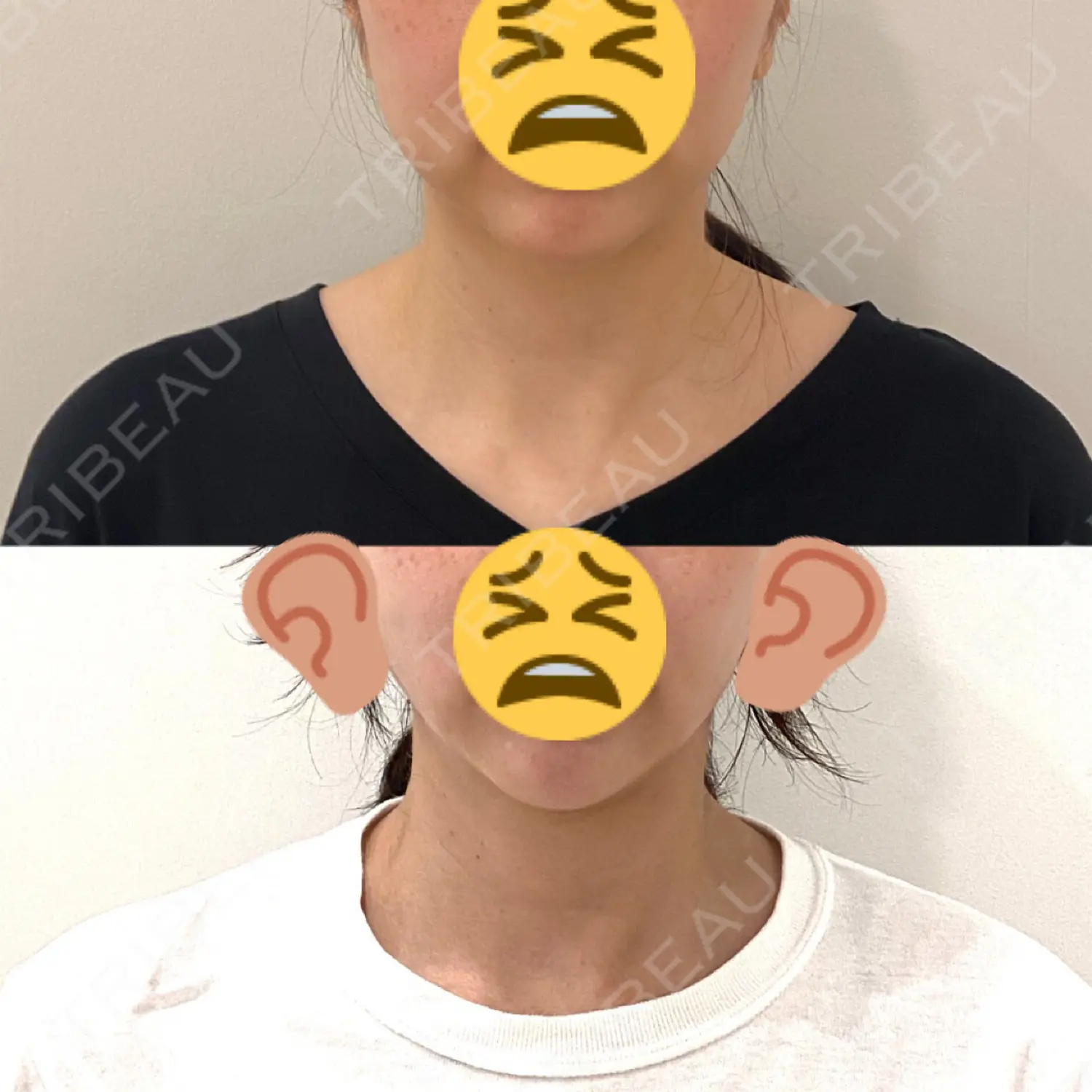 施術後の写真