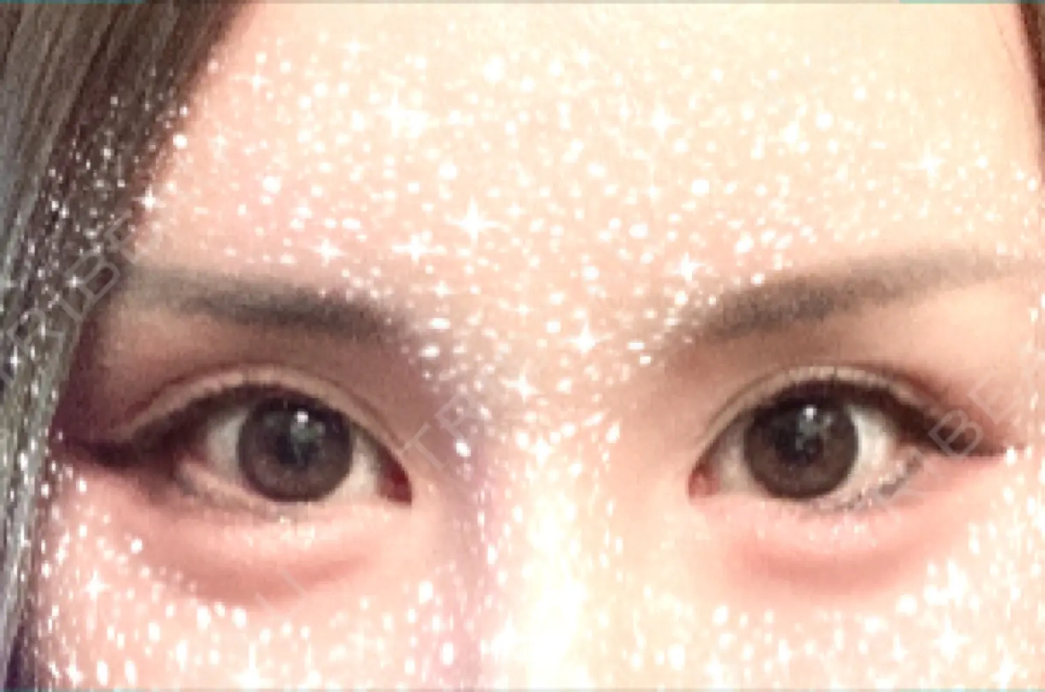 施術後の写真