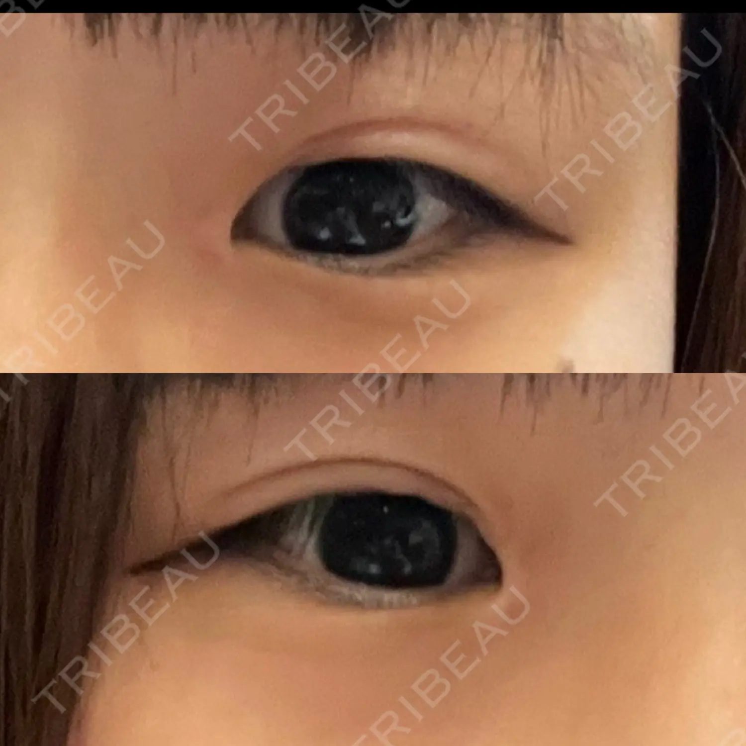 施術後の写真