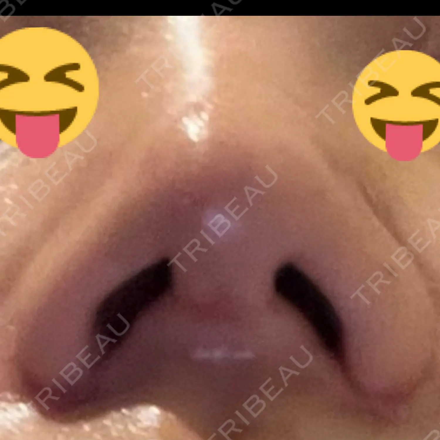 施術後の写真