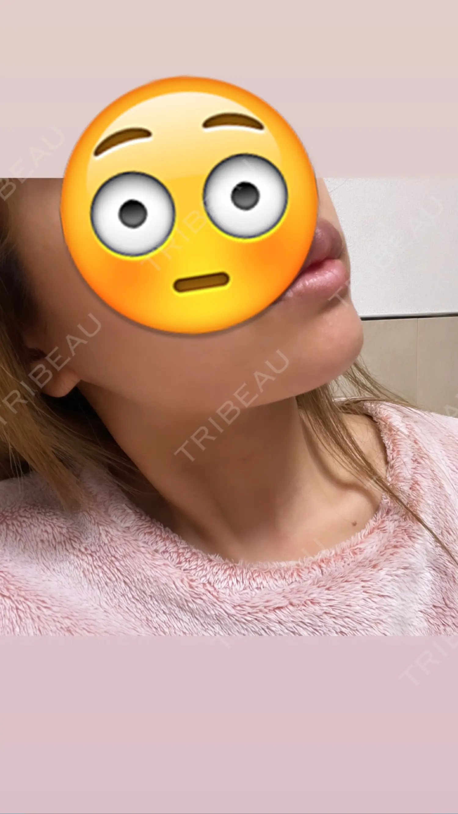 施術後の写真