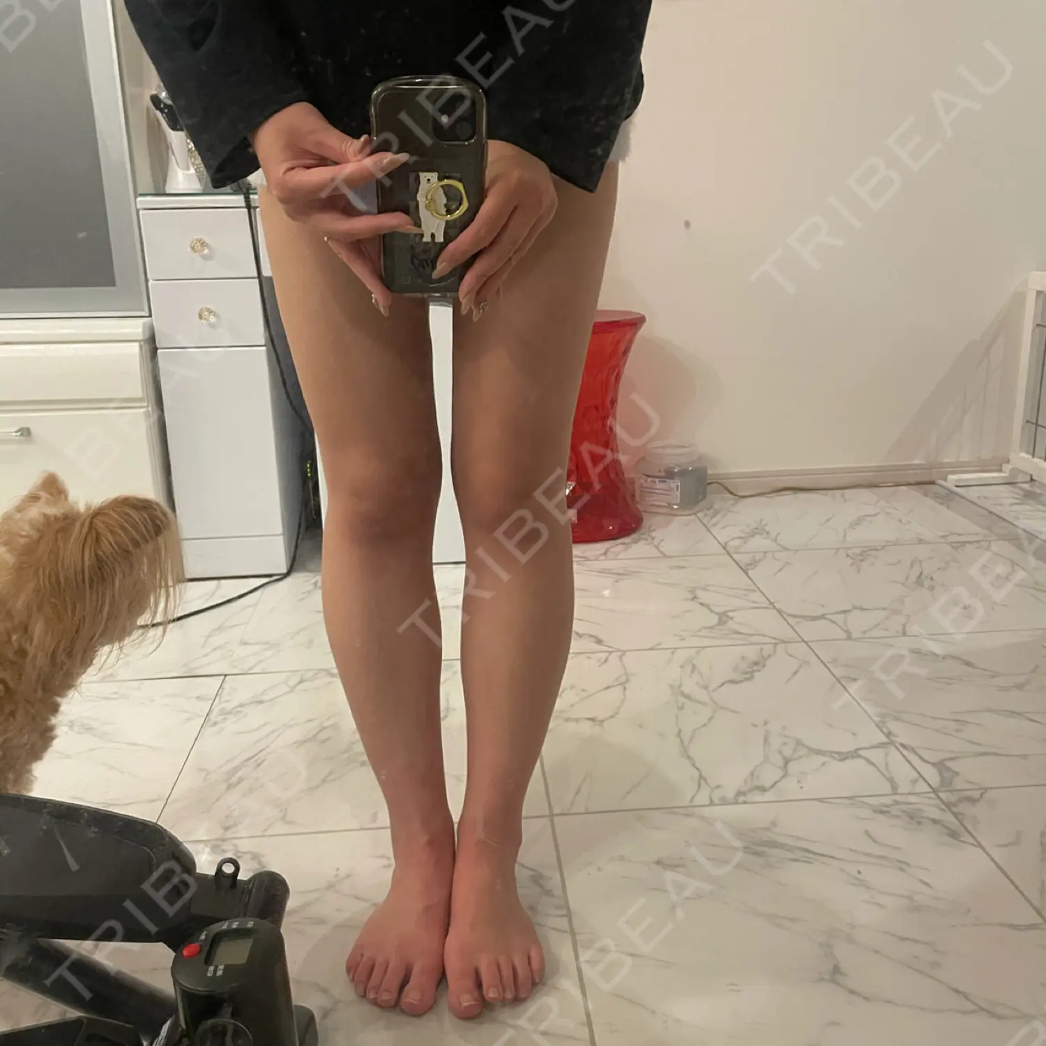 施術後の写真