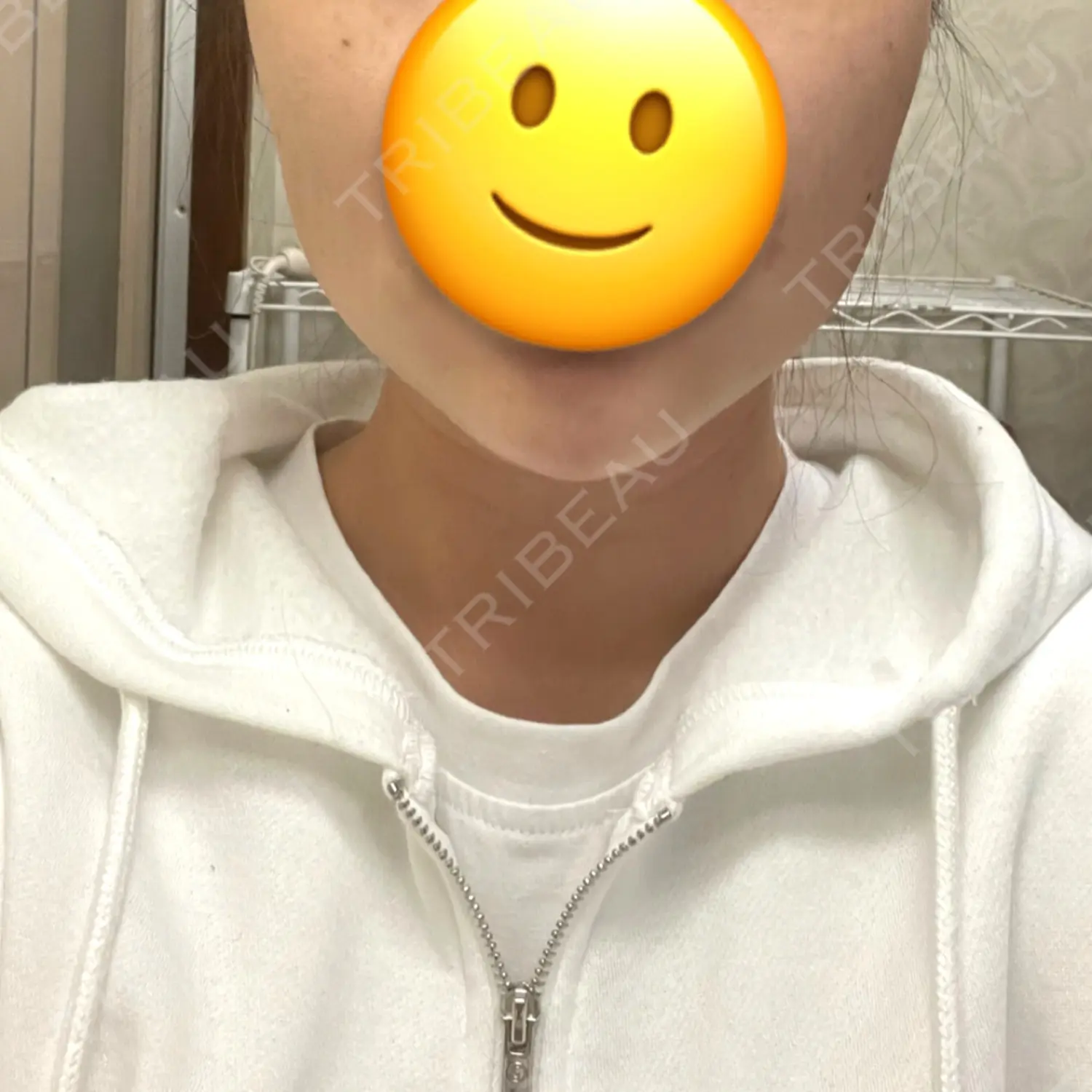 施術後の写真