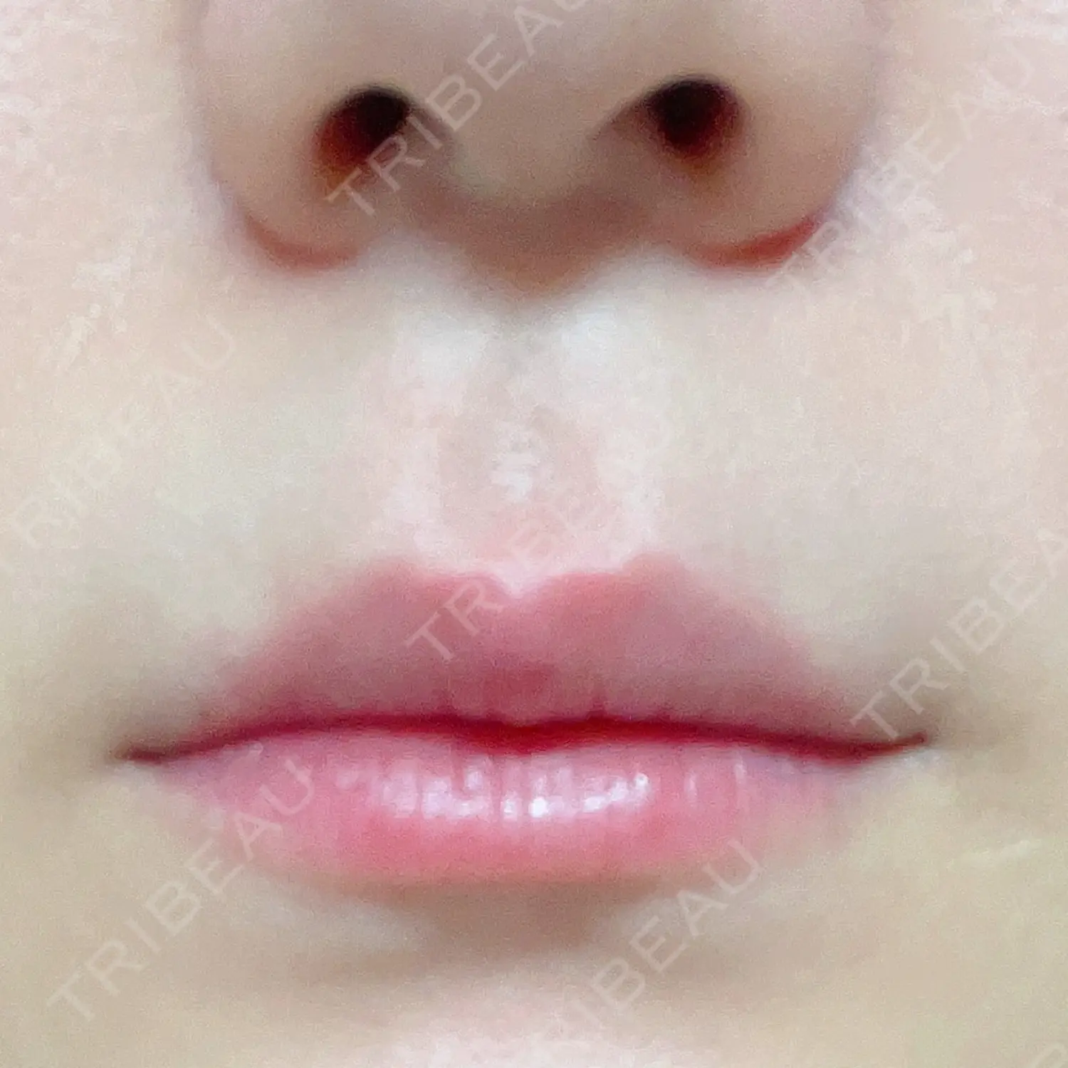 施術後の写真
