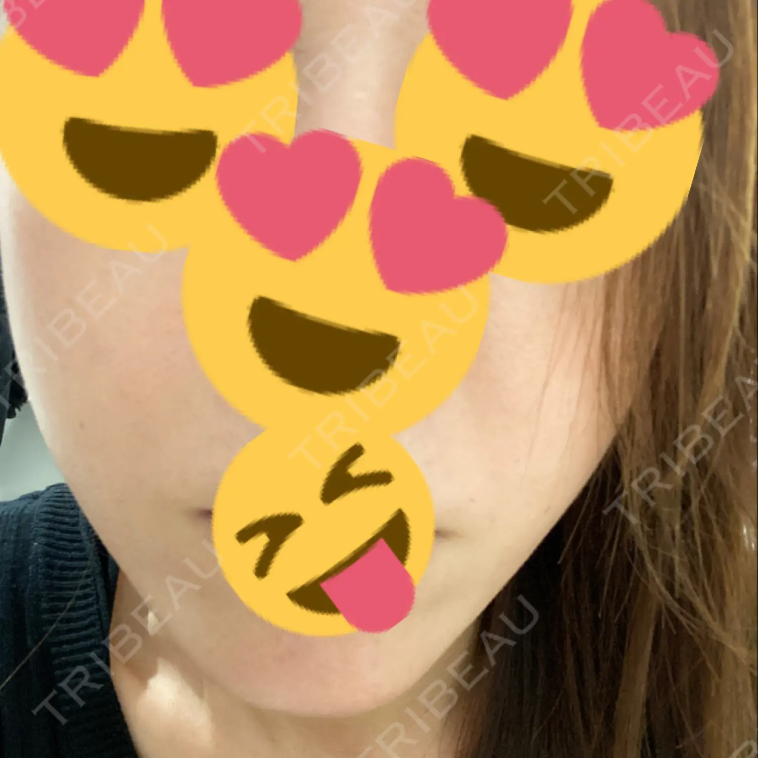 施術後の写真