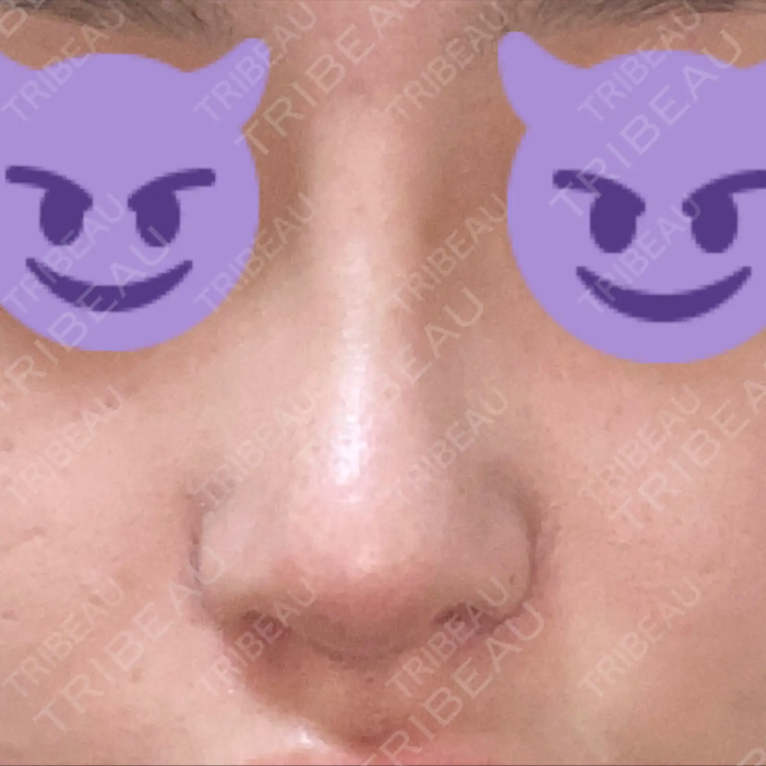 施術後の写真