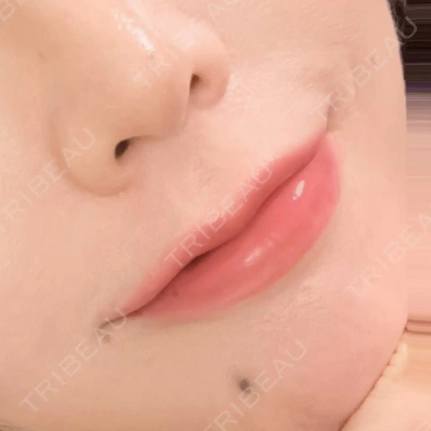 施術後の写真
