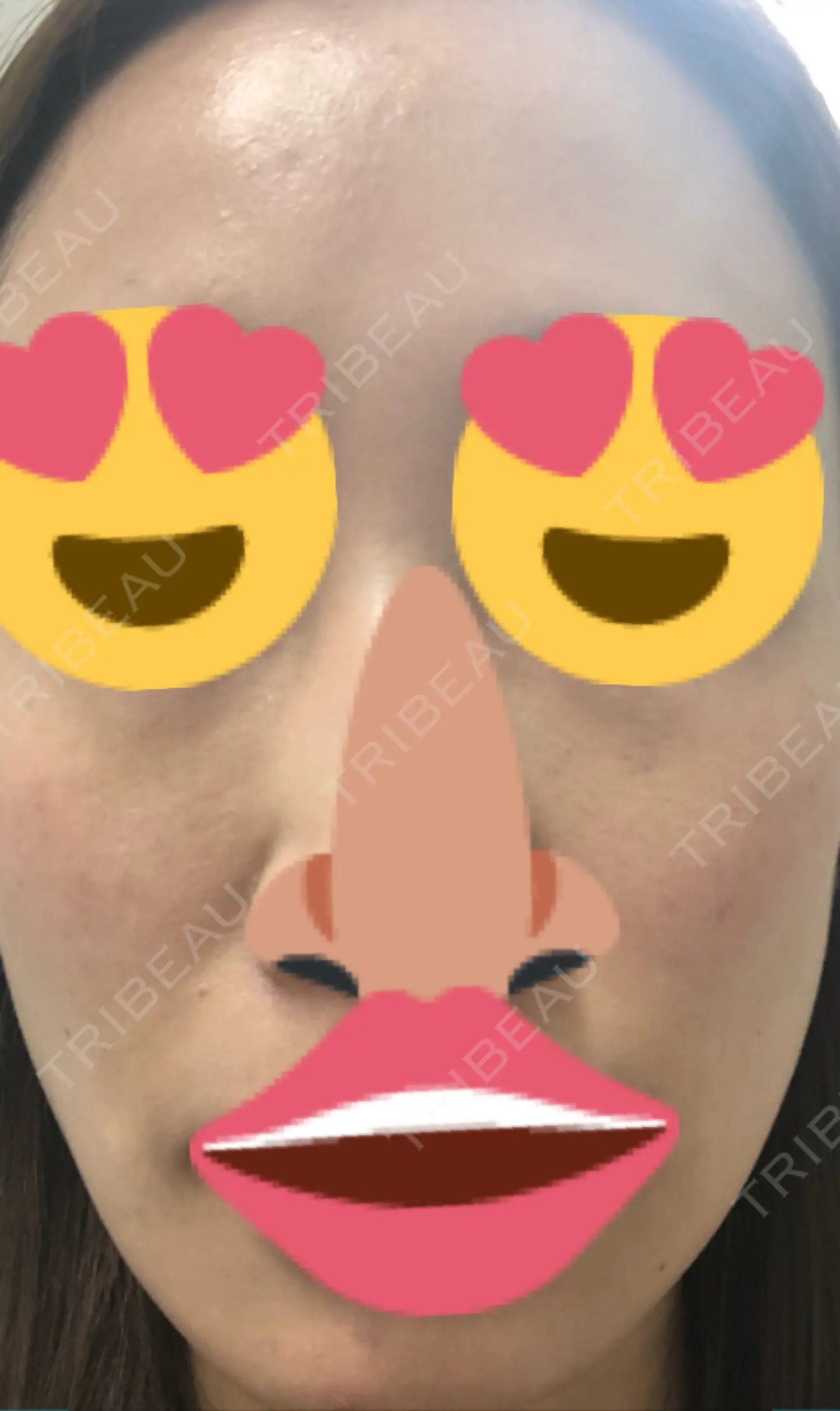施術後の写真