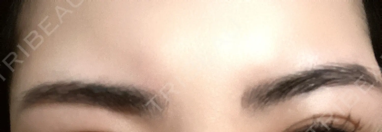 施術後の写真