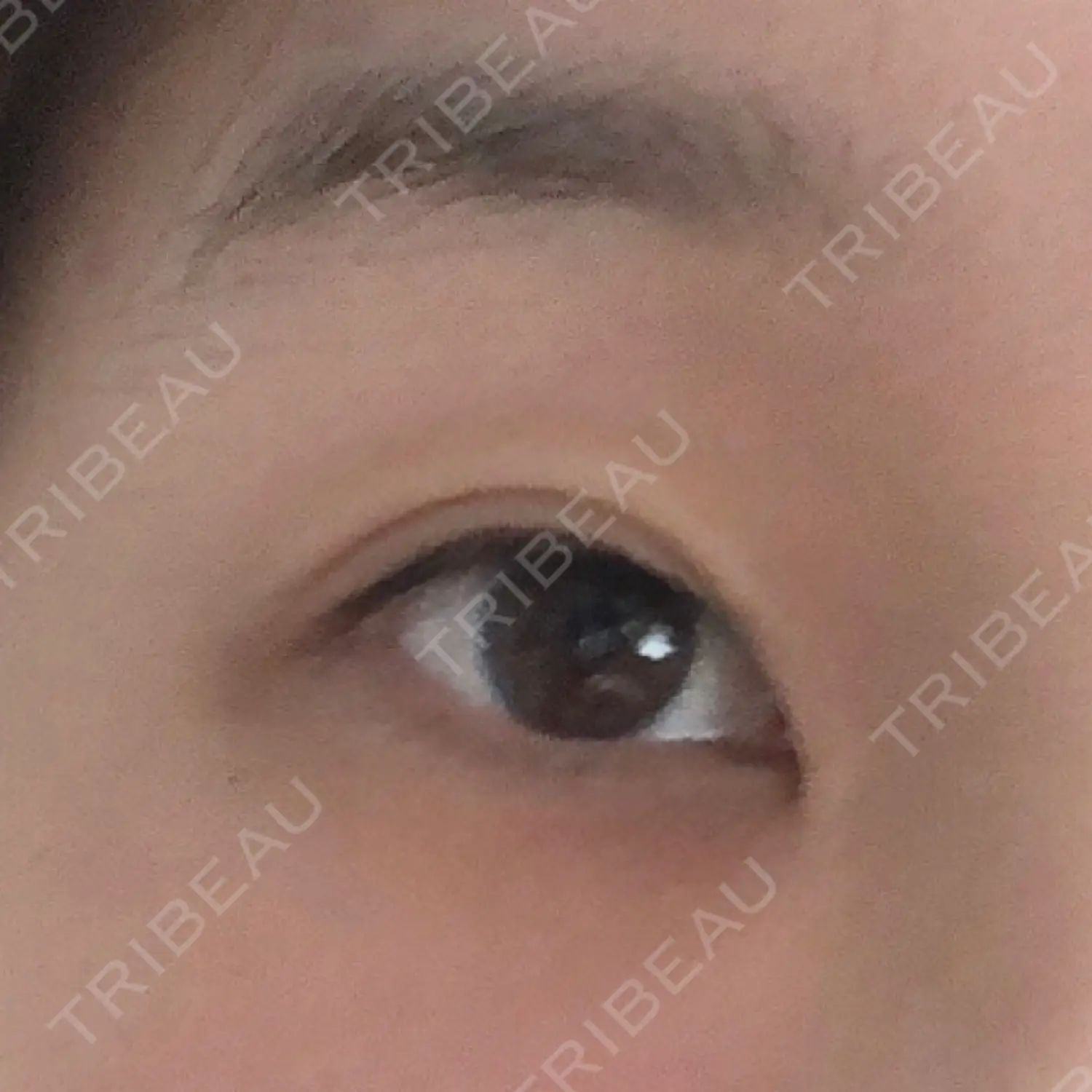 施術後の写真