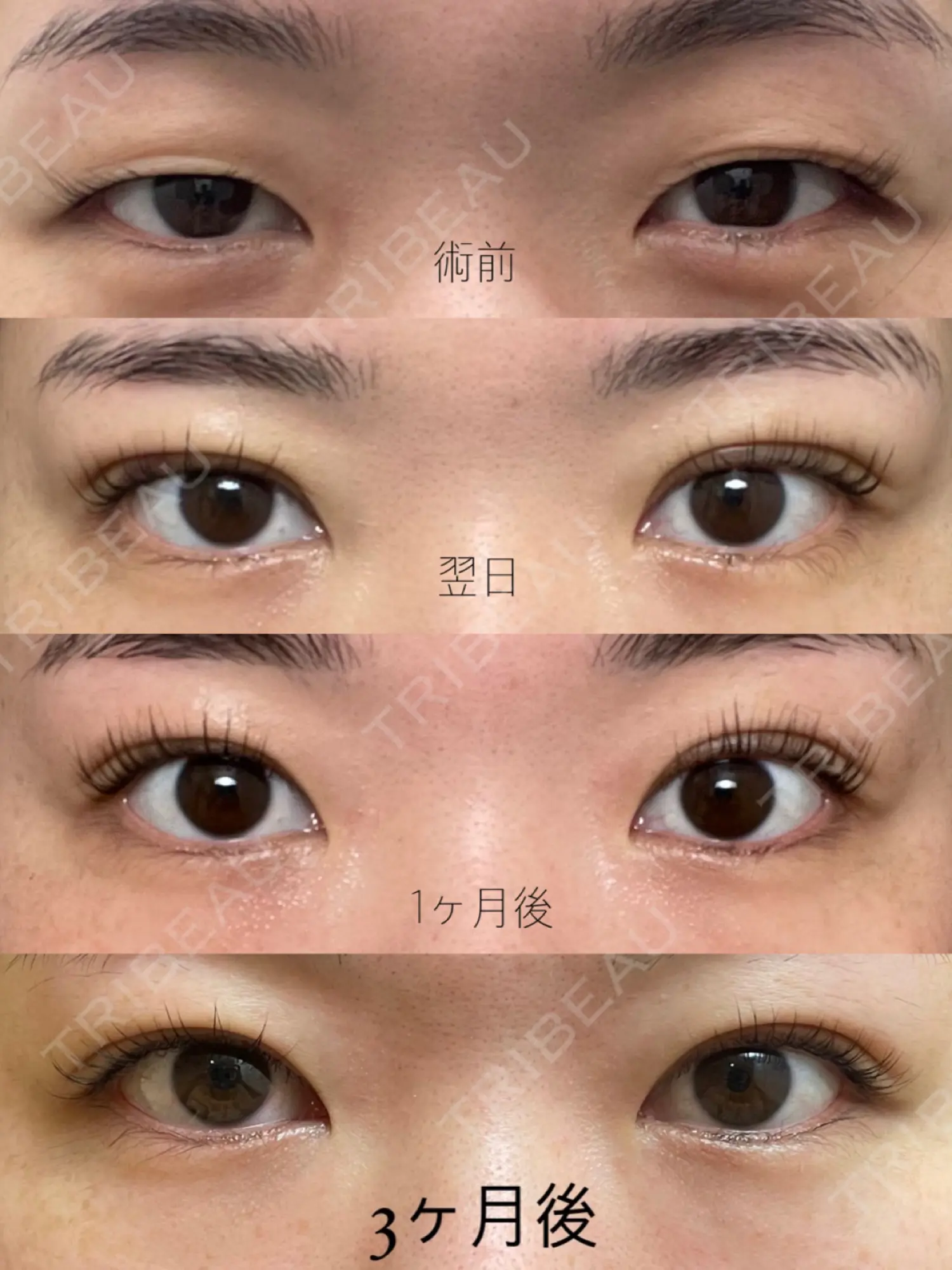 施術後の写真