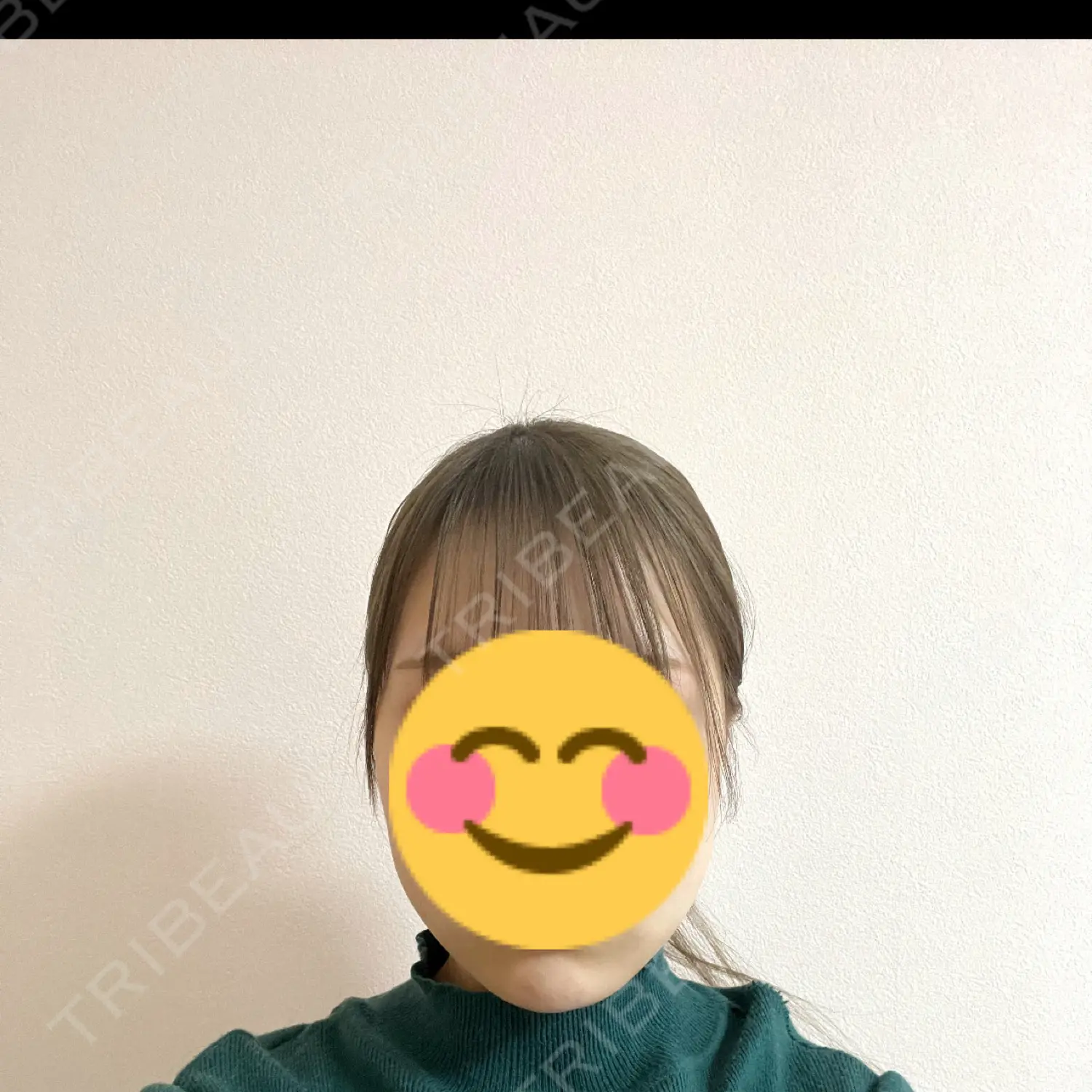 施術後の写真