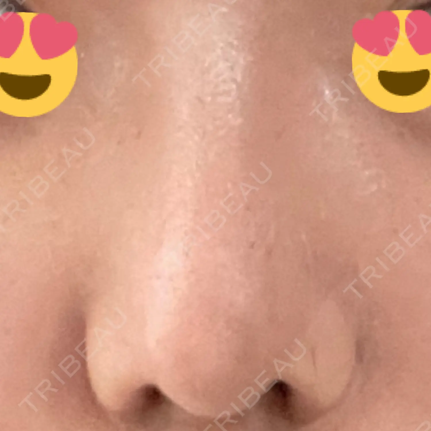 施術後の写真