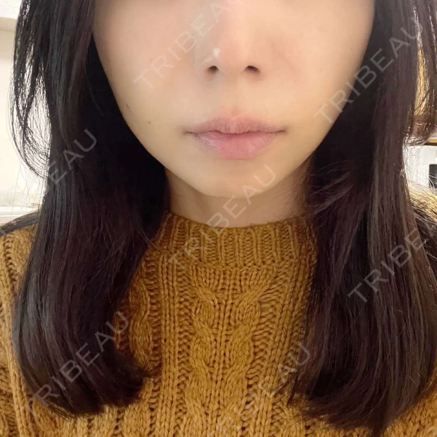 施術後の写真