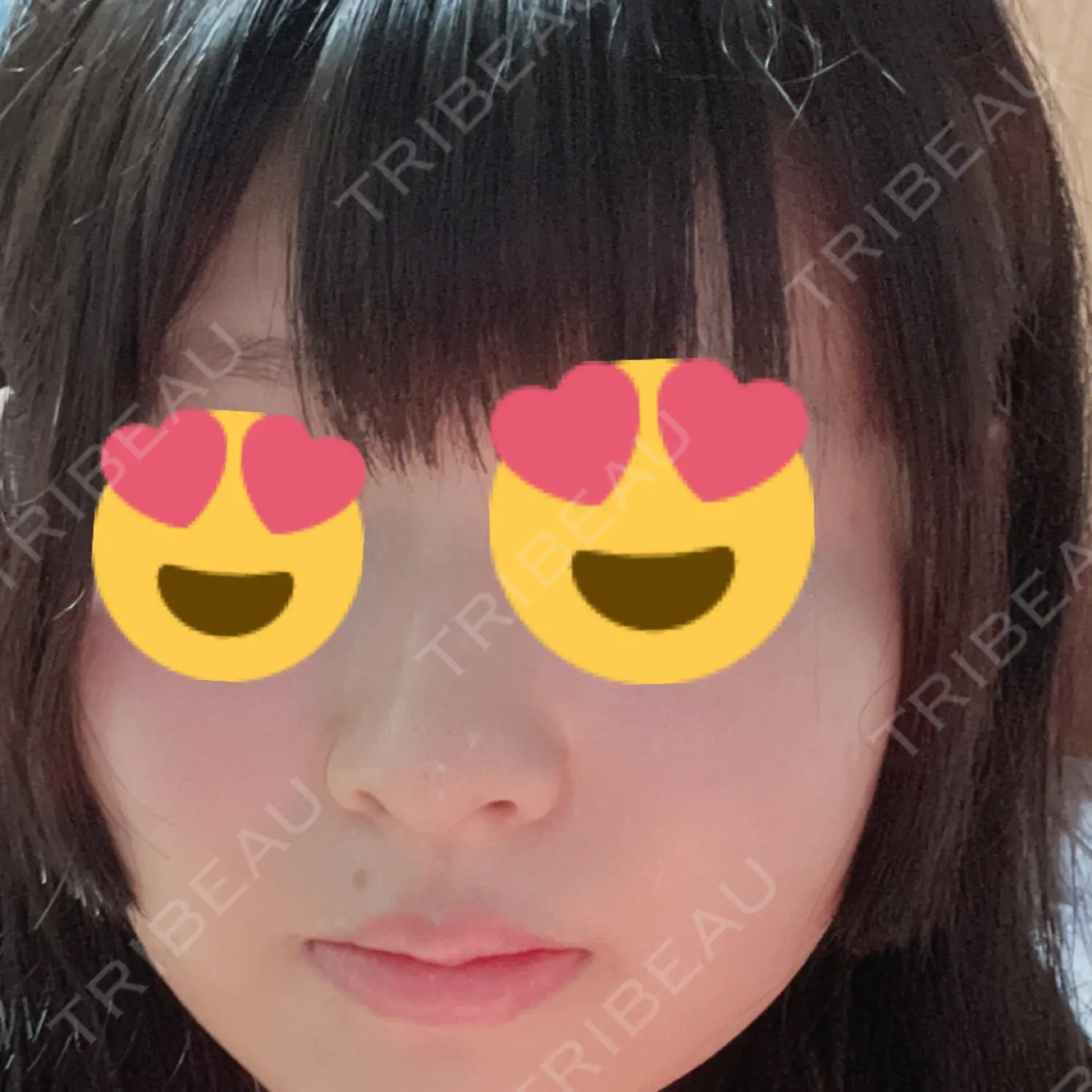 施術後の写真
