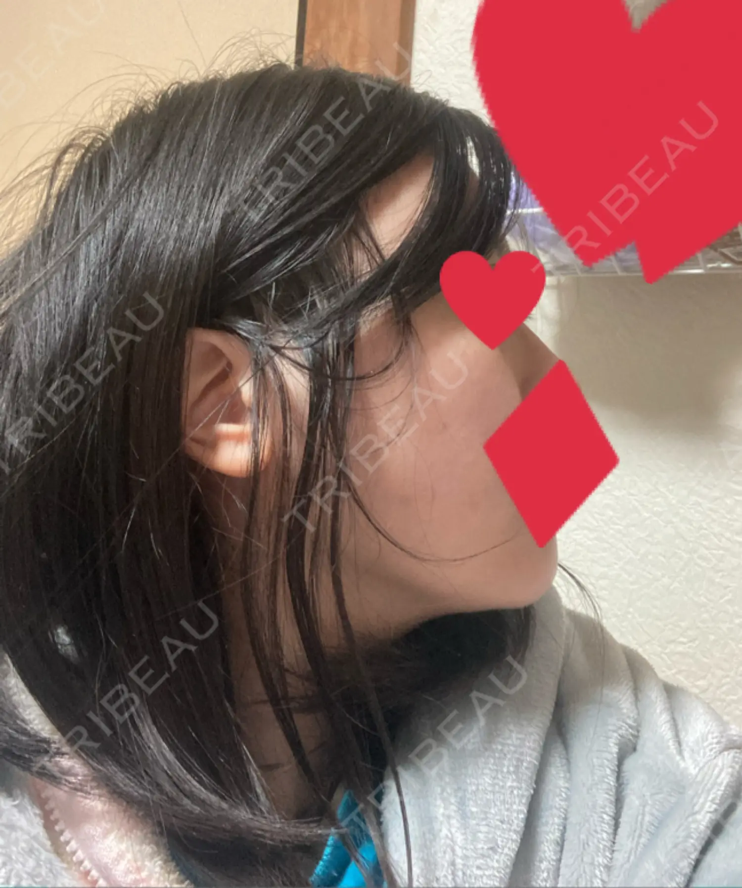 施術後の写真