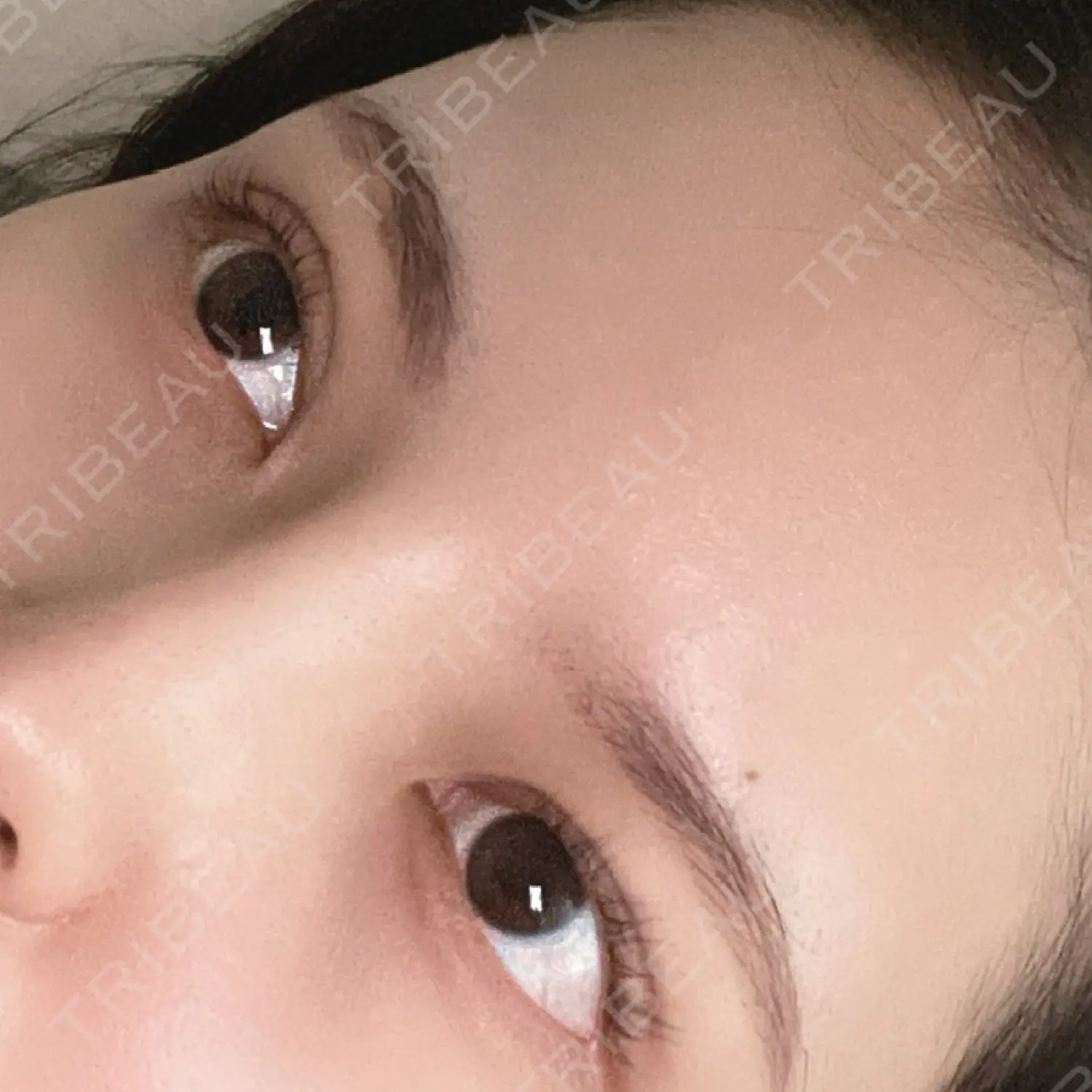 施術後の写真