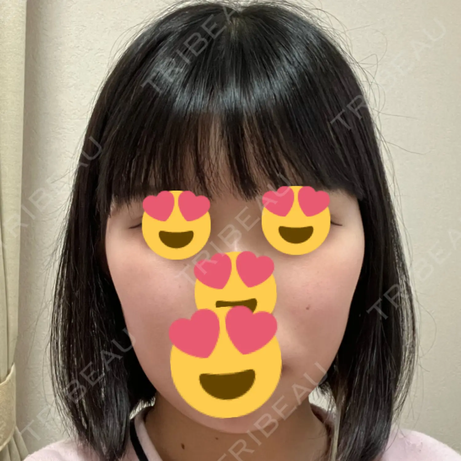 施術後の写真