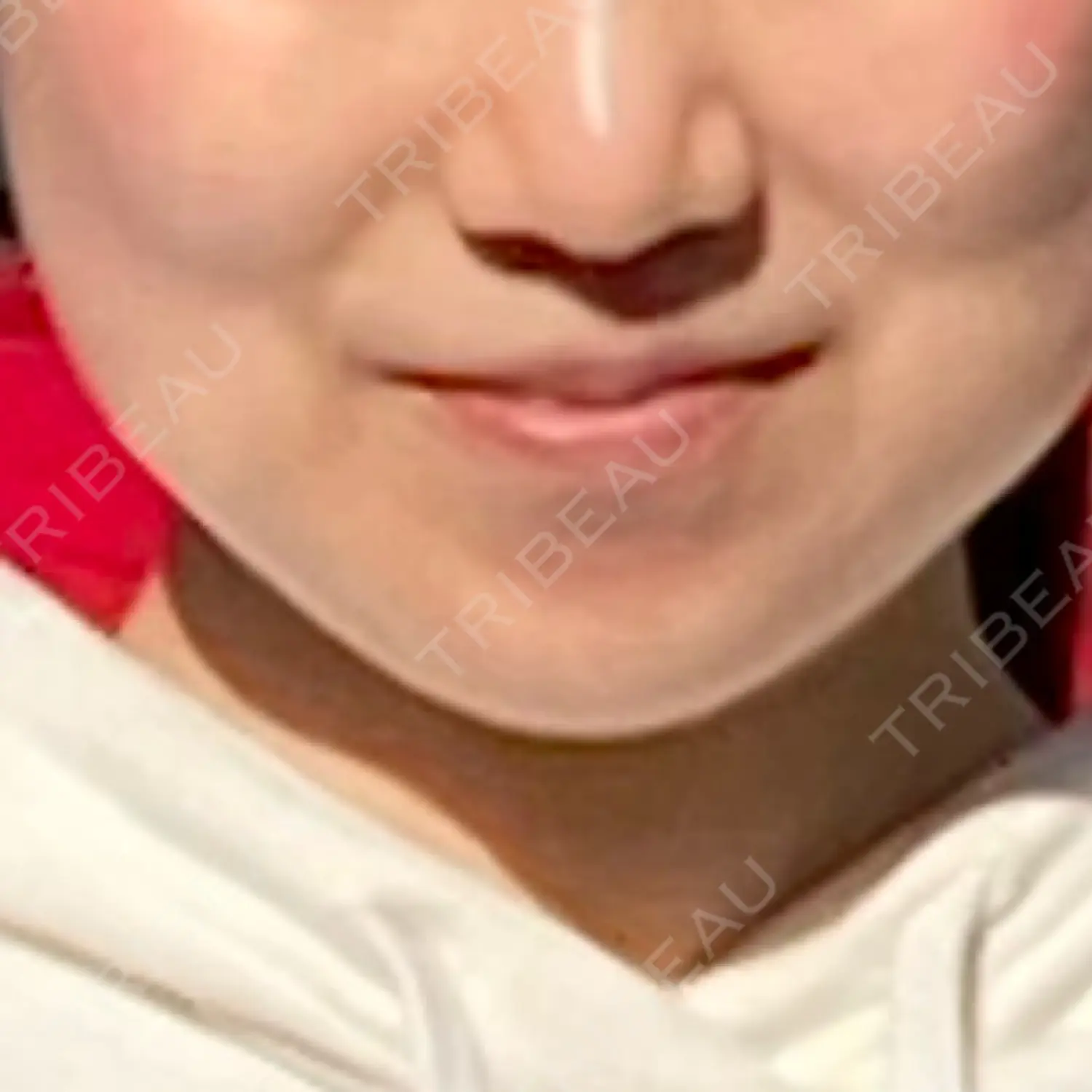 施術後の写真