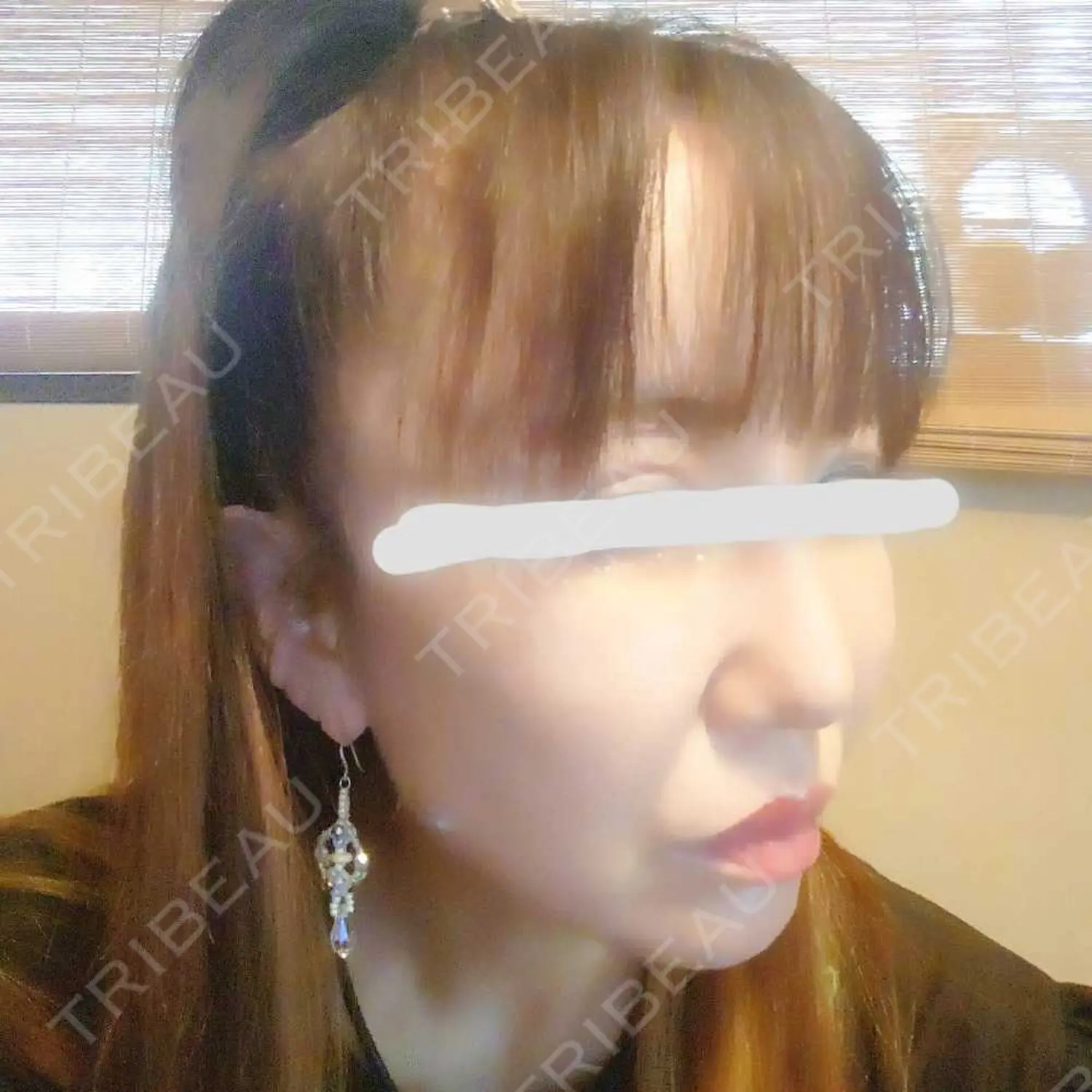 施術後の写真