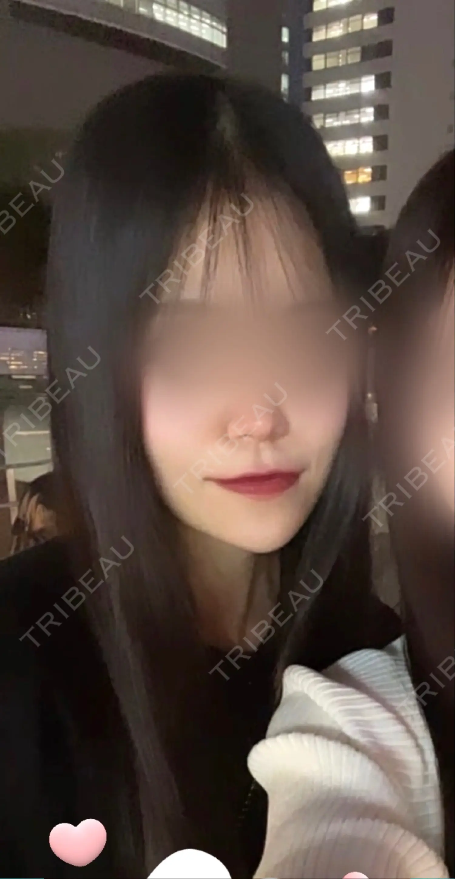 施術後の写真