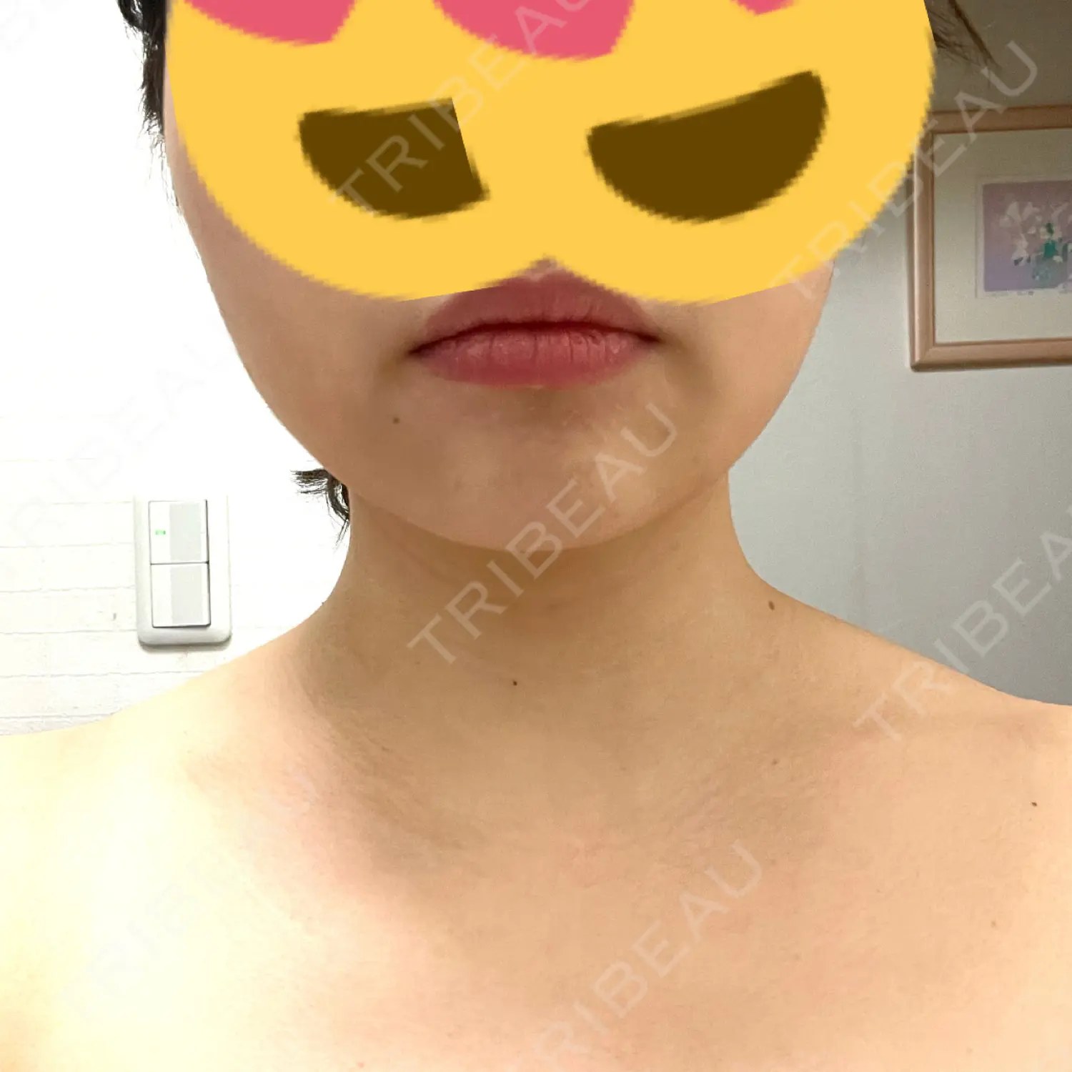 施術後の写真