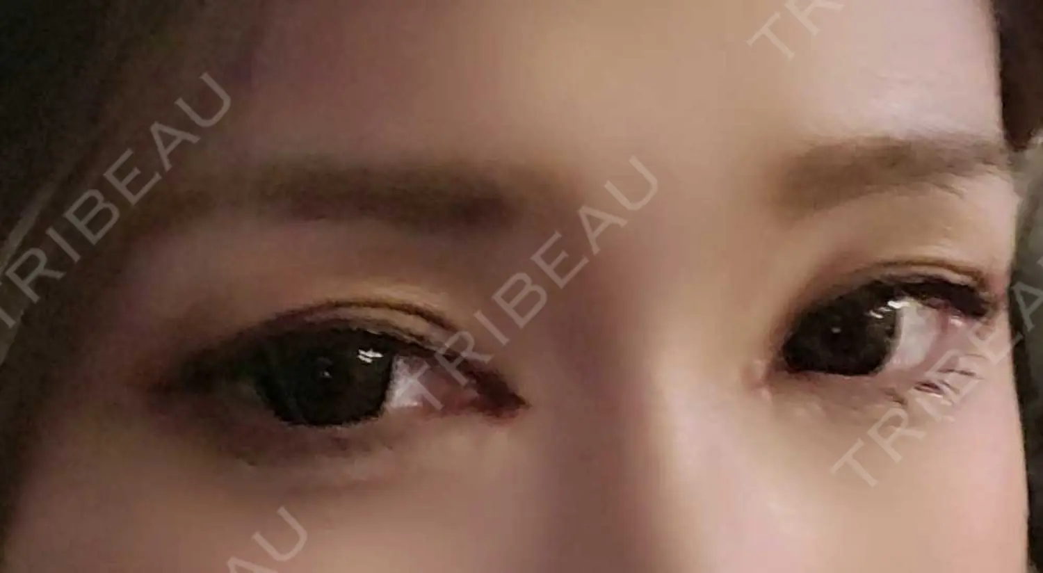 施術後の写真