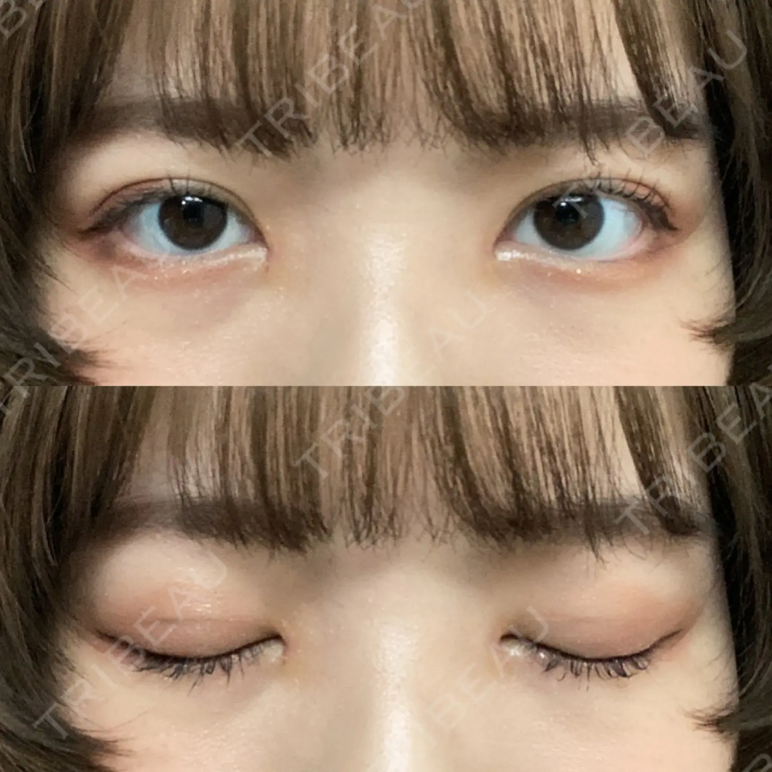 施術後の写真