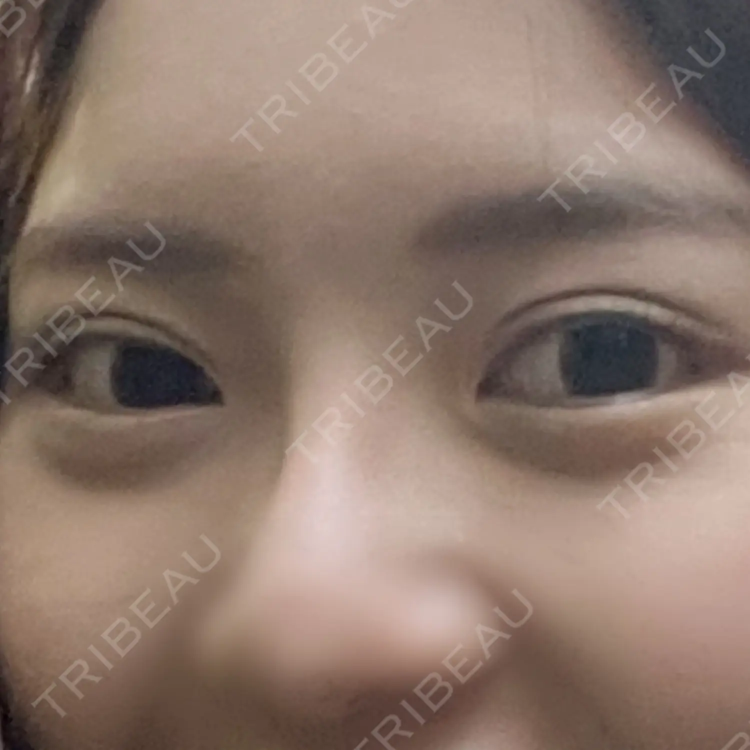施術後の写真