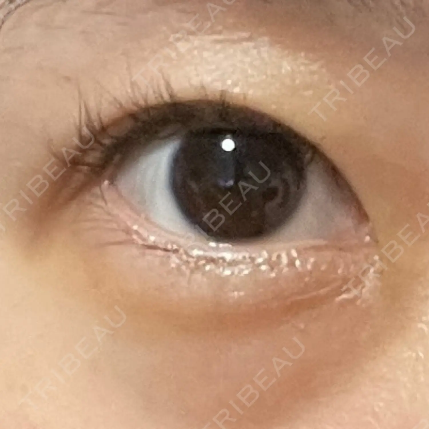 施術後の写真
