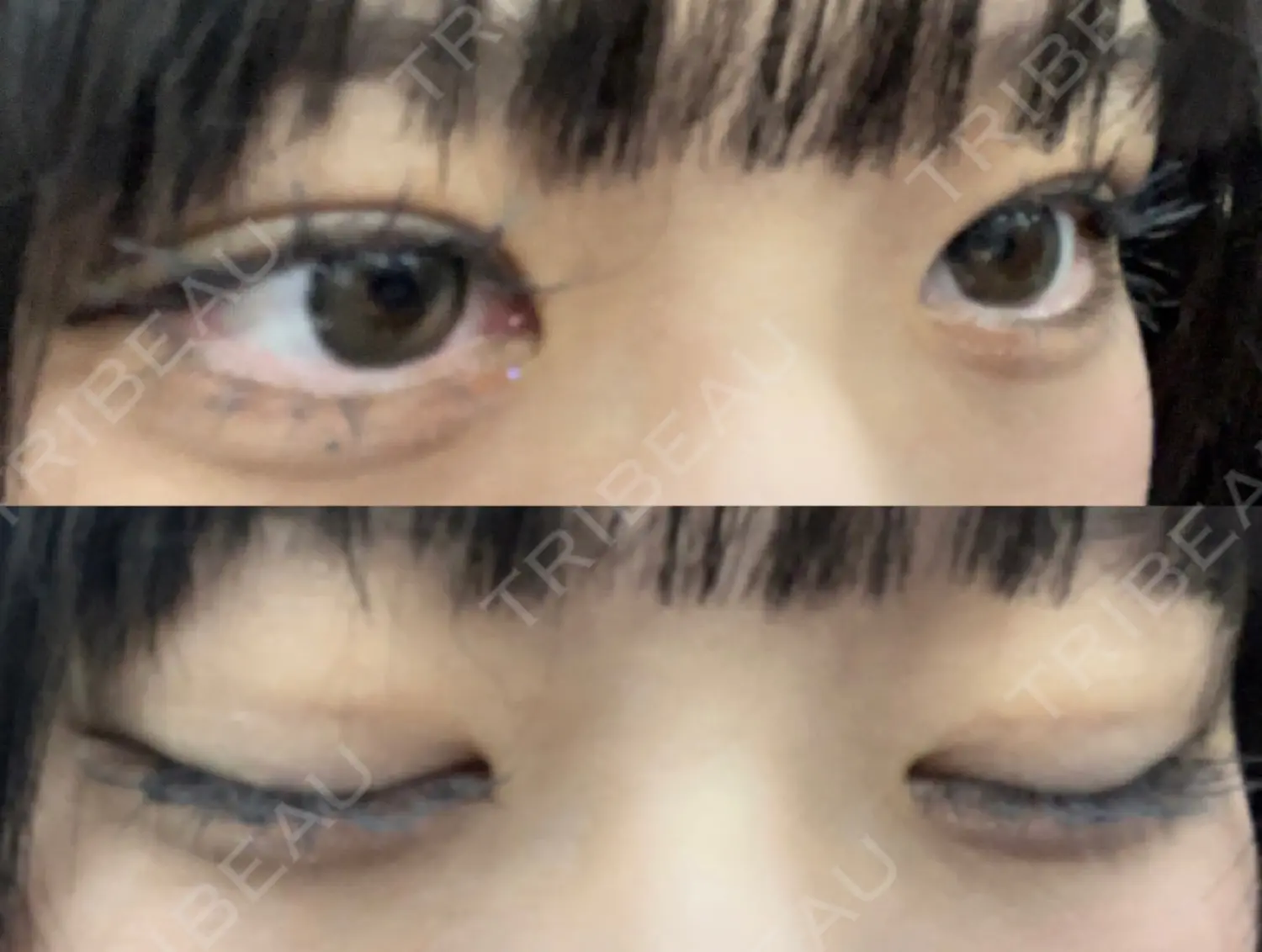 施術後の写真