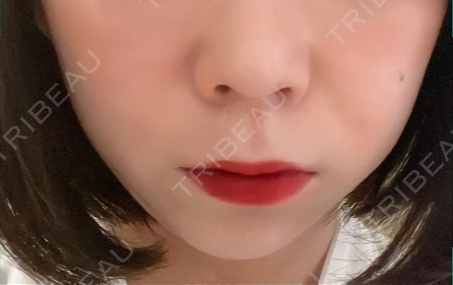 施術後の写真