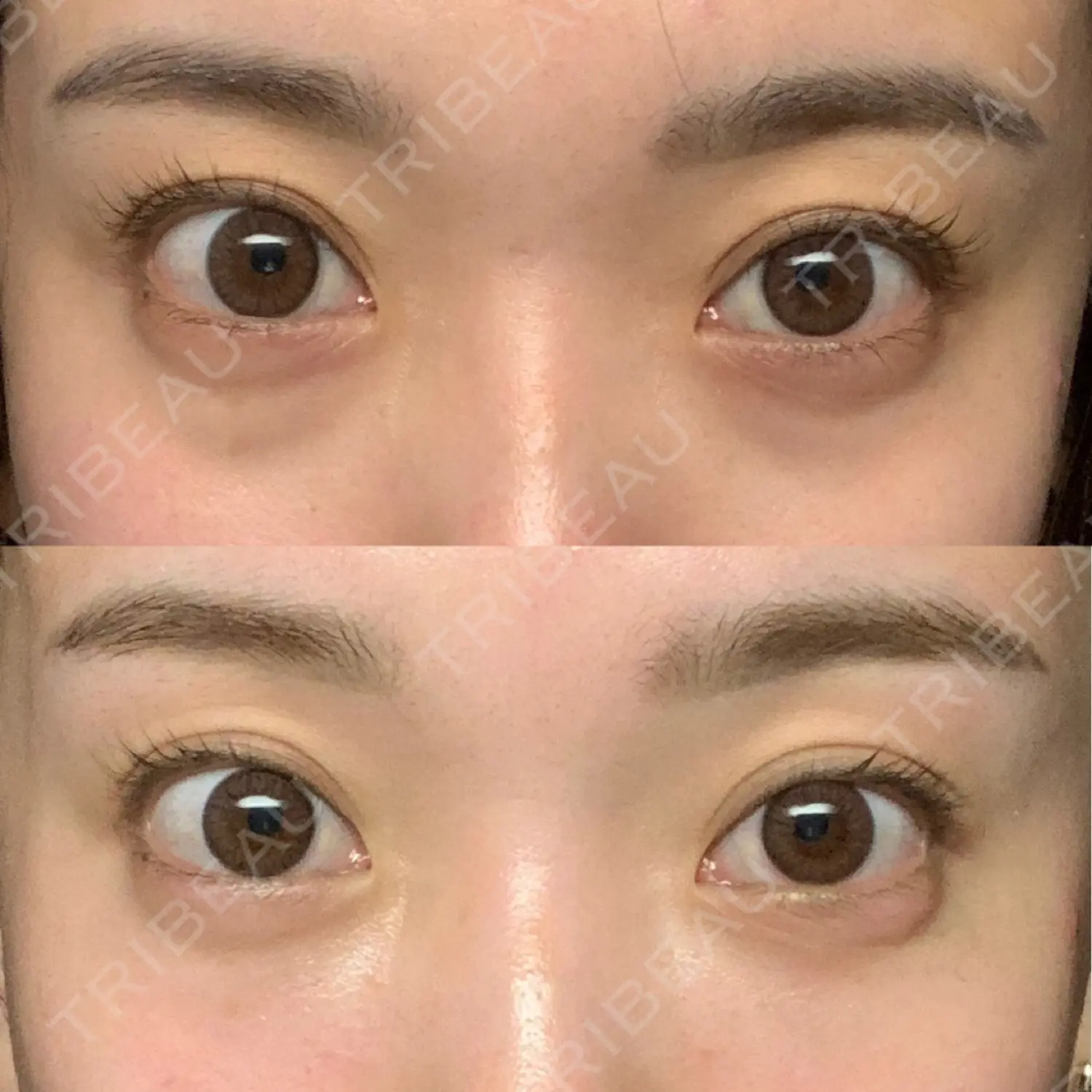 施術後の写真