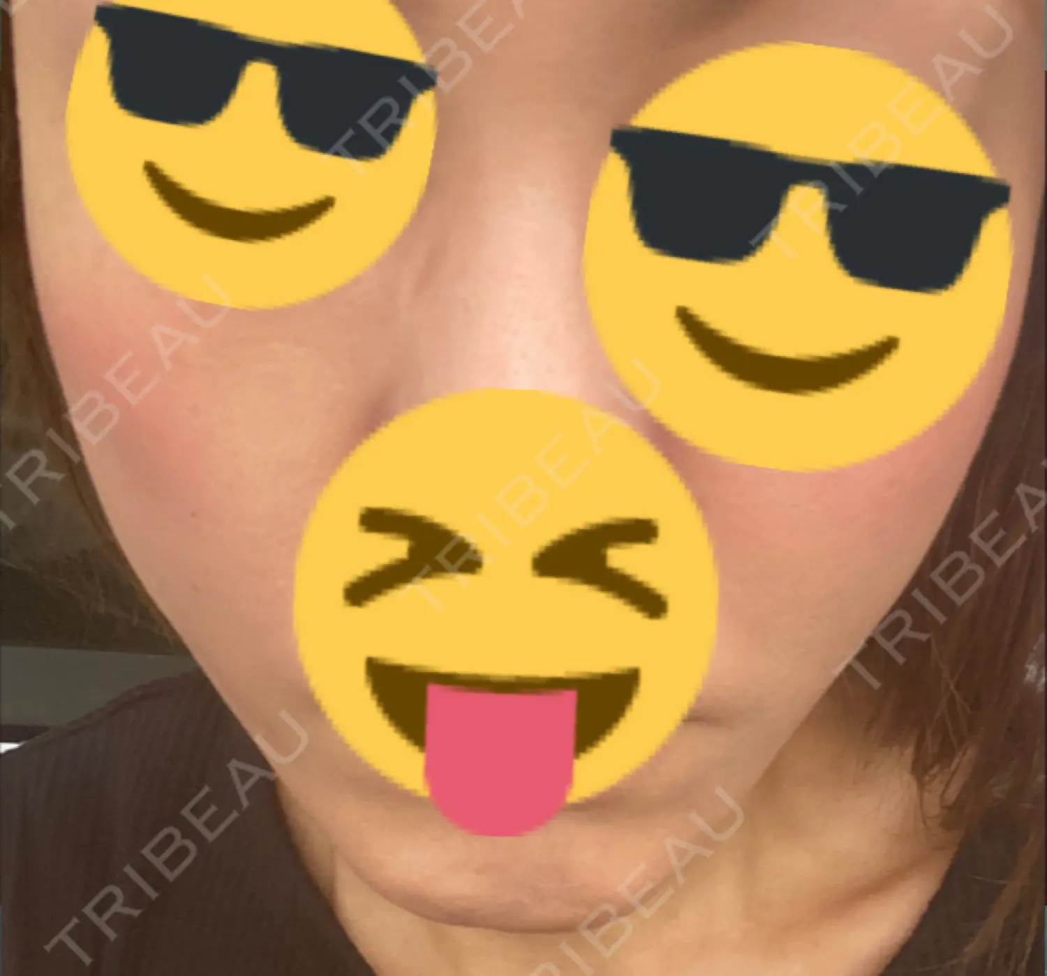 施術後の写真